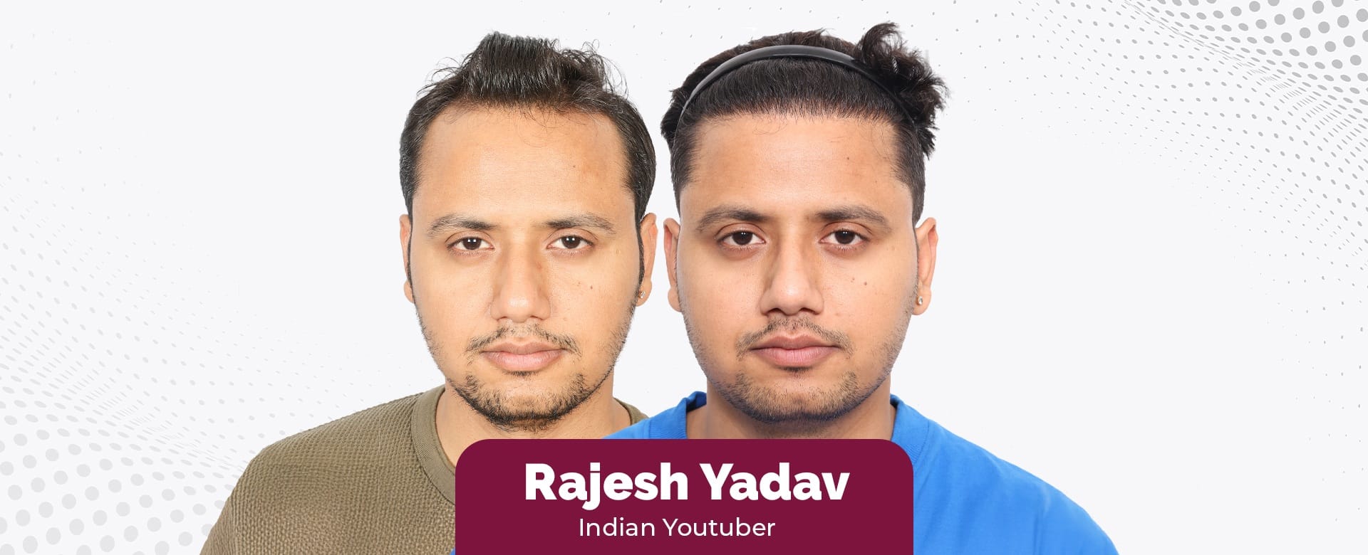 New Hair, New Styles: YouTuber Rajesh Yadav’s Stunning Makeover After His Hair Transplant at Eugenix