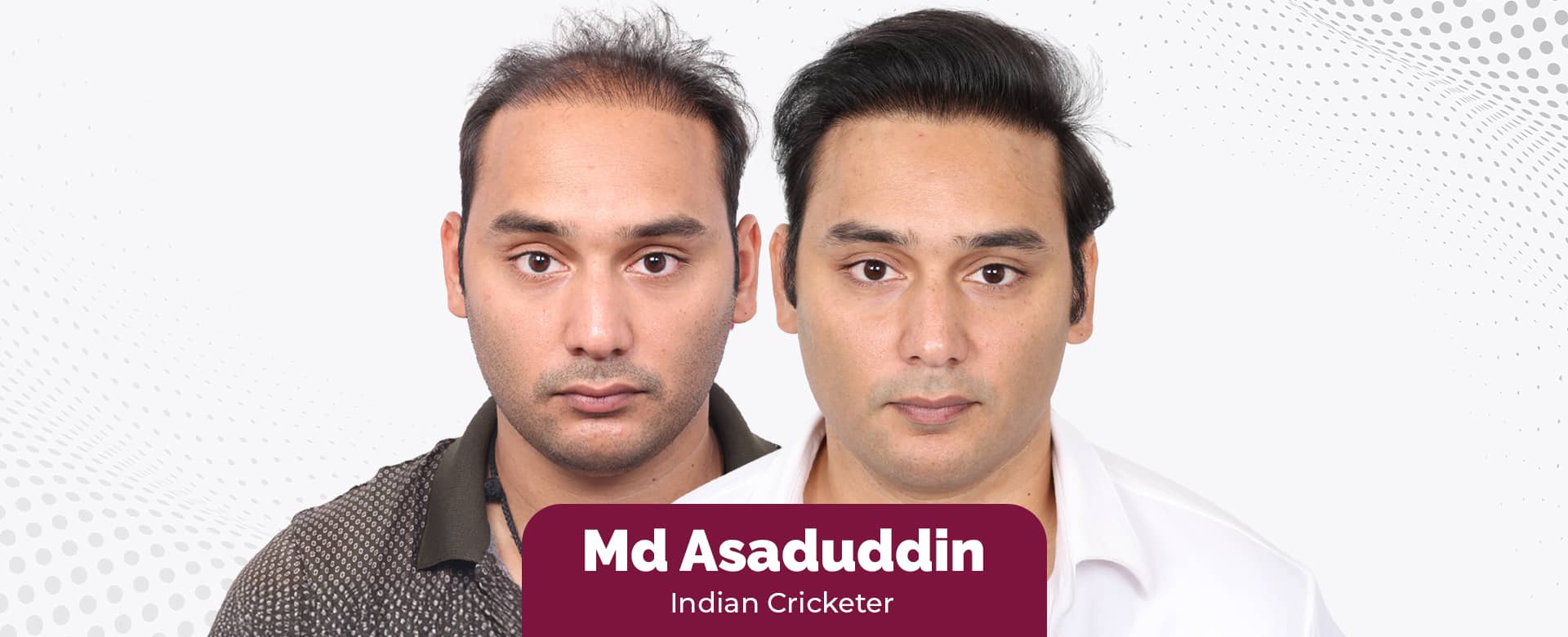 From Cricket Fields to Confidence: Cricketer Mohammed Asaduddin’s Hair Transformation at Eugenix