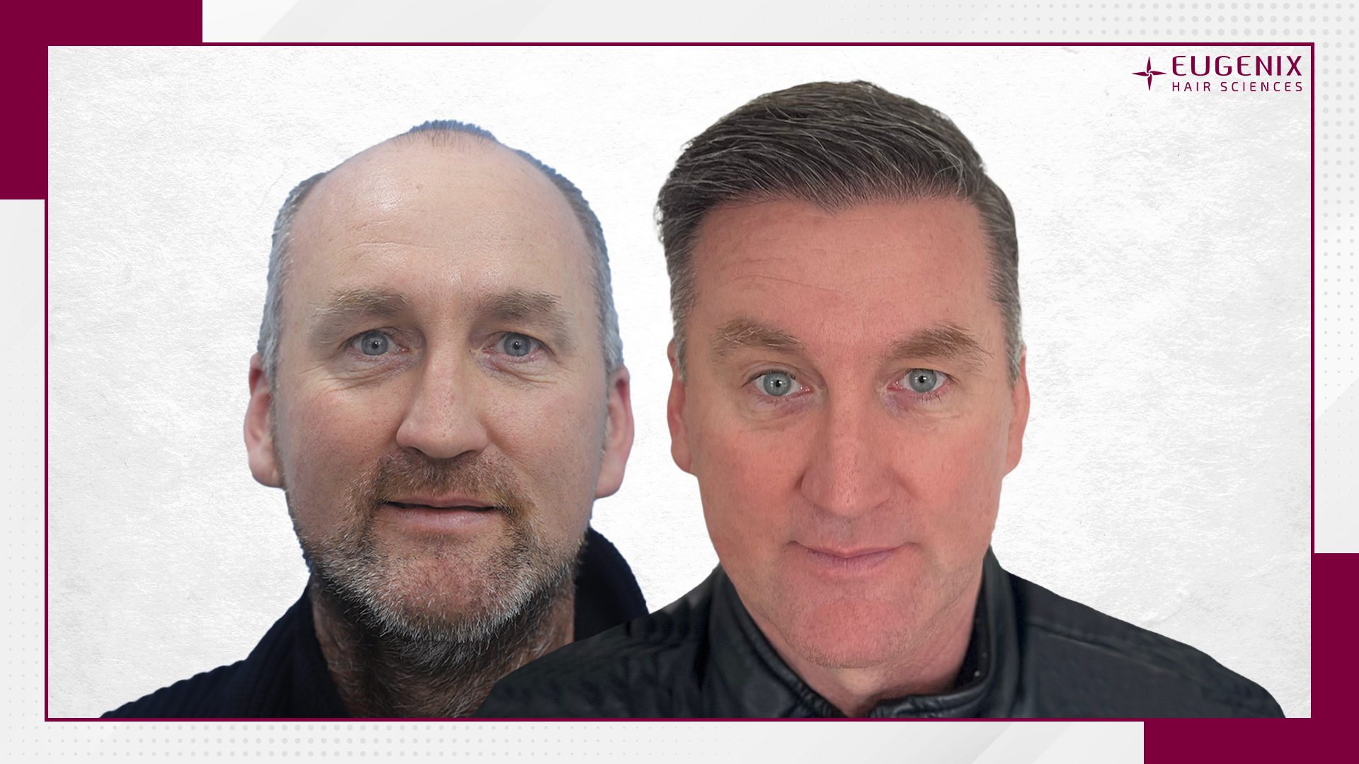 KW-Before-After