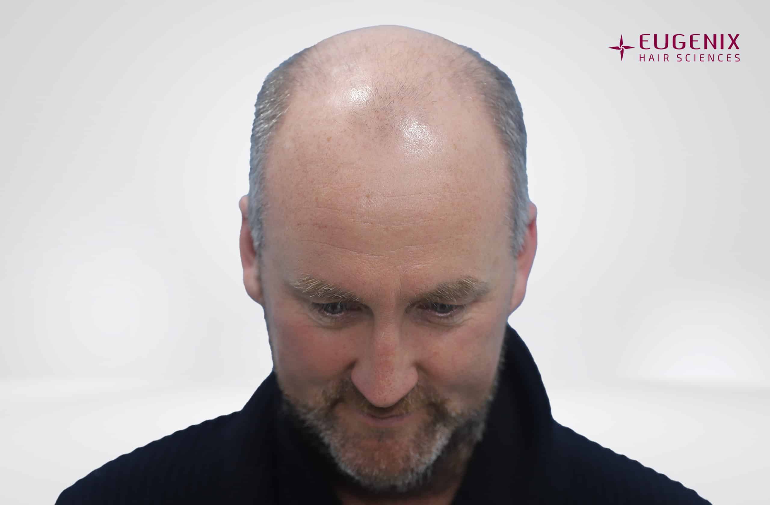 KW Head Down Before