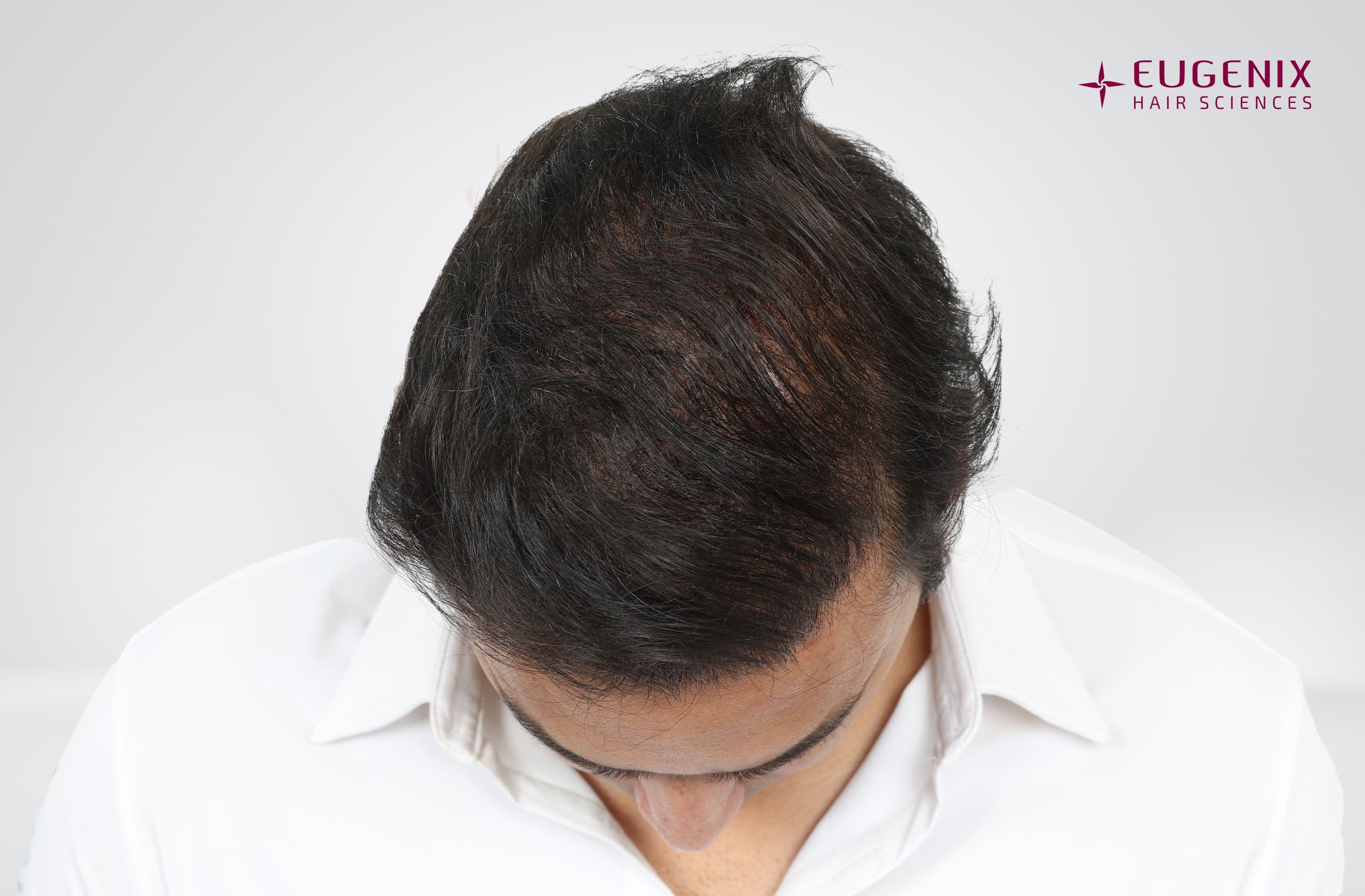 Mohammad Asaduddin After Head Down copy