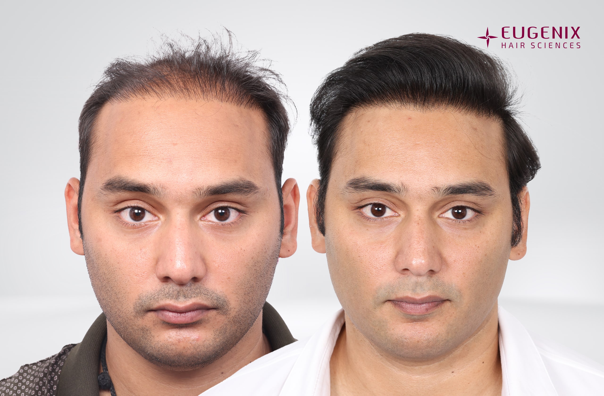 Mohammad Asaduddin After and Before Front copy