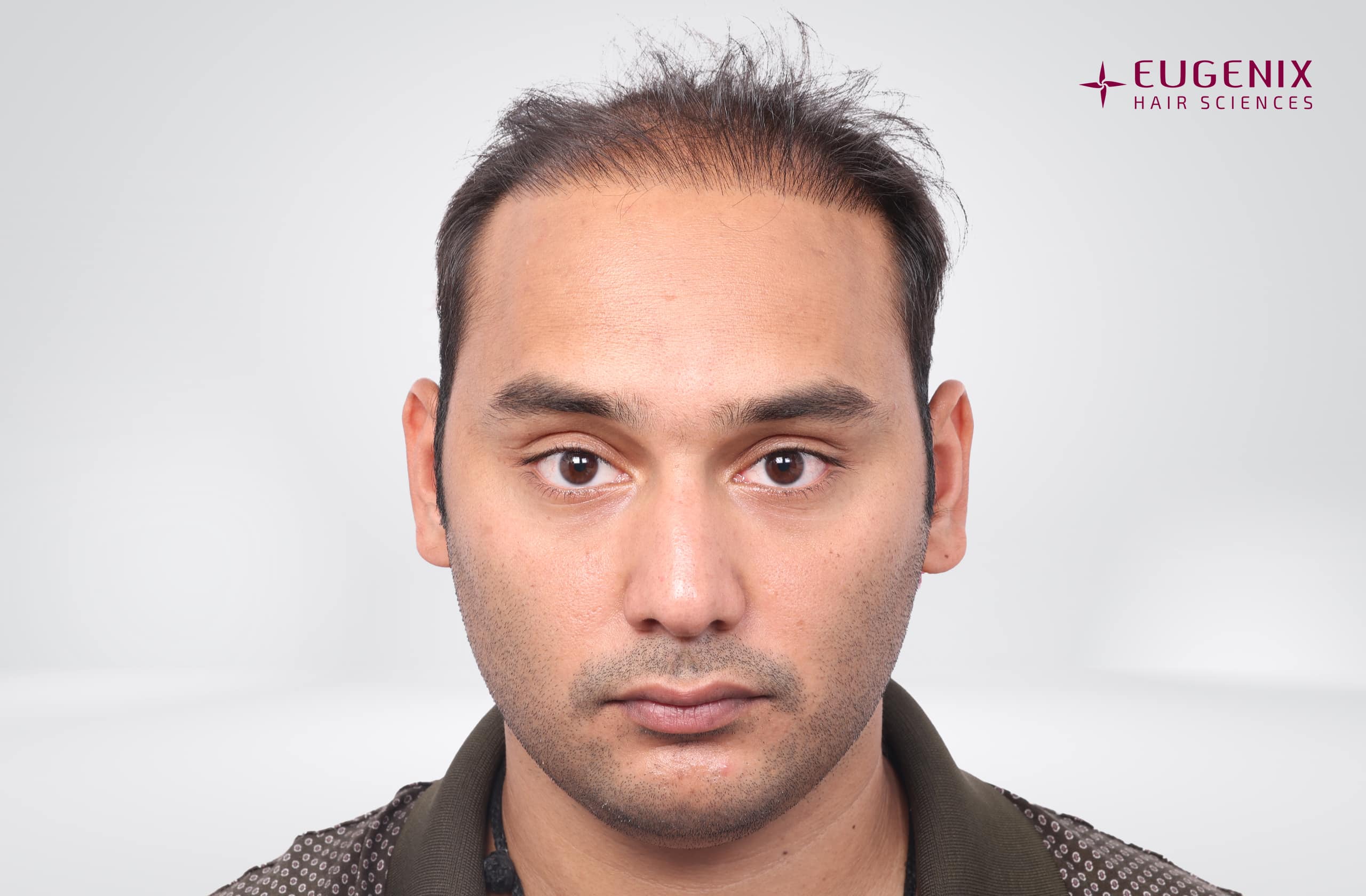 Mohammad Asaduddin Before Front copy