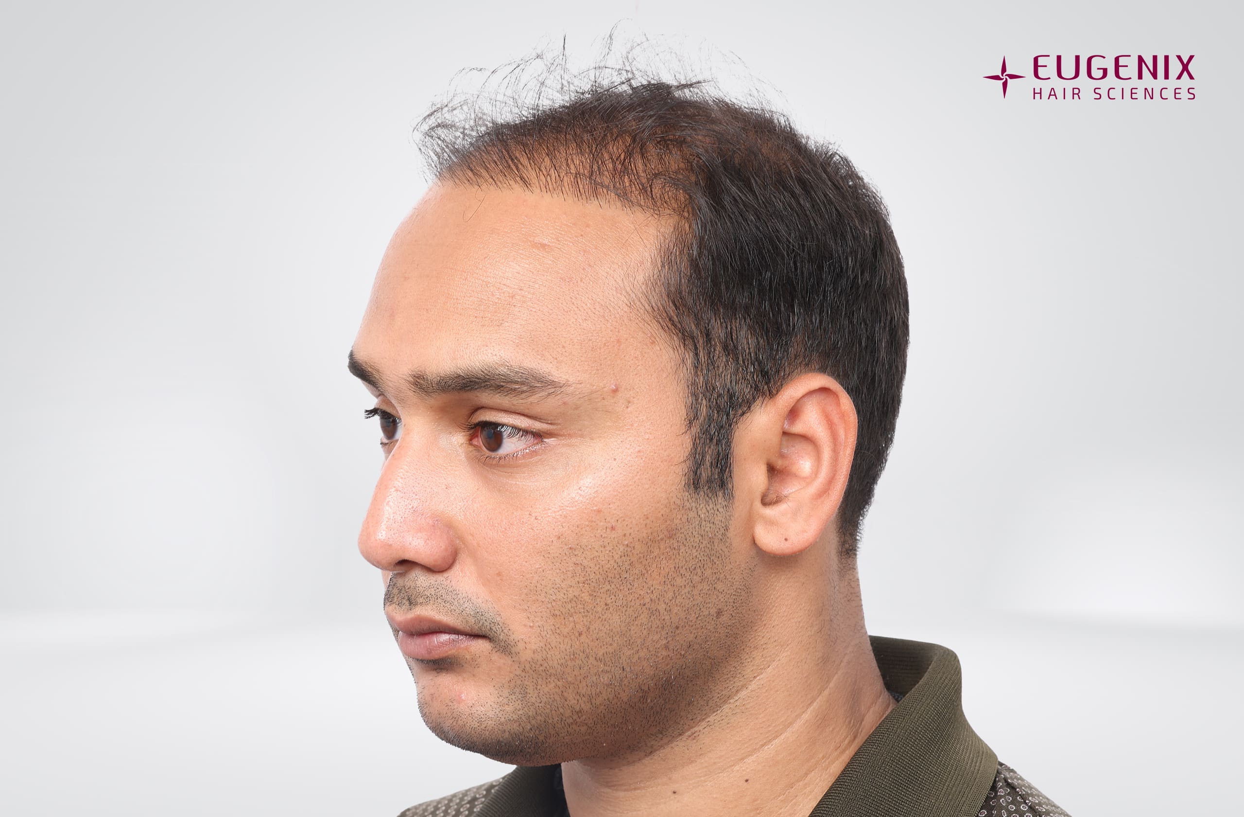 Mohammad Asaduddin Before Right copy