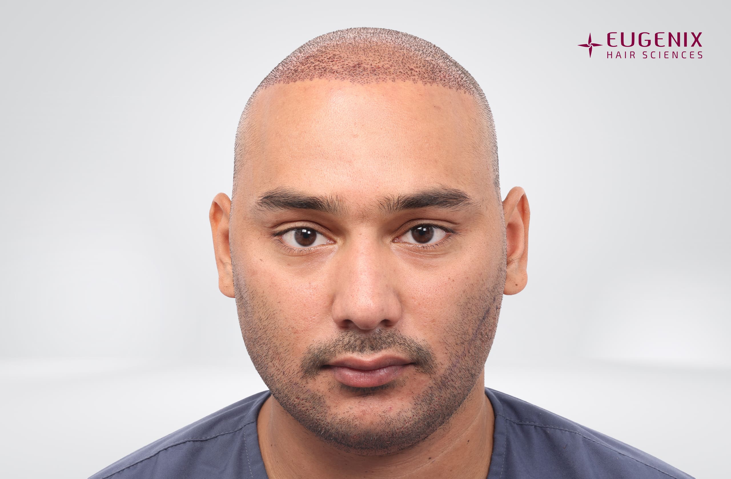 Mohammad Asaduddin Post-op Front copy