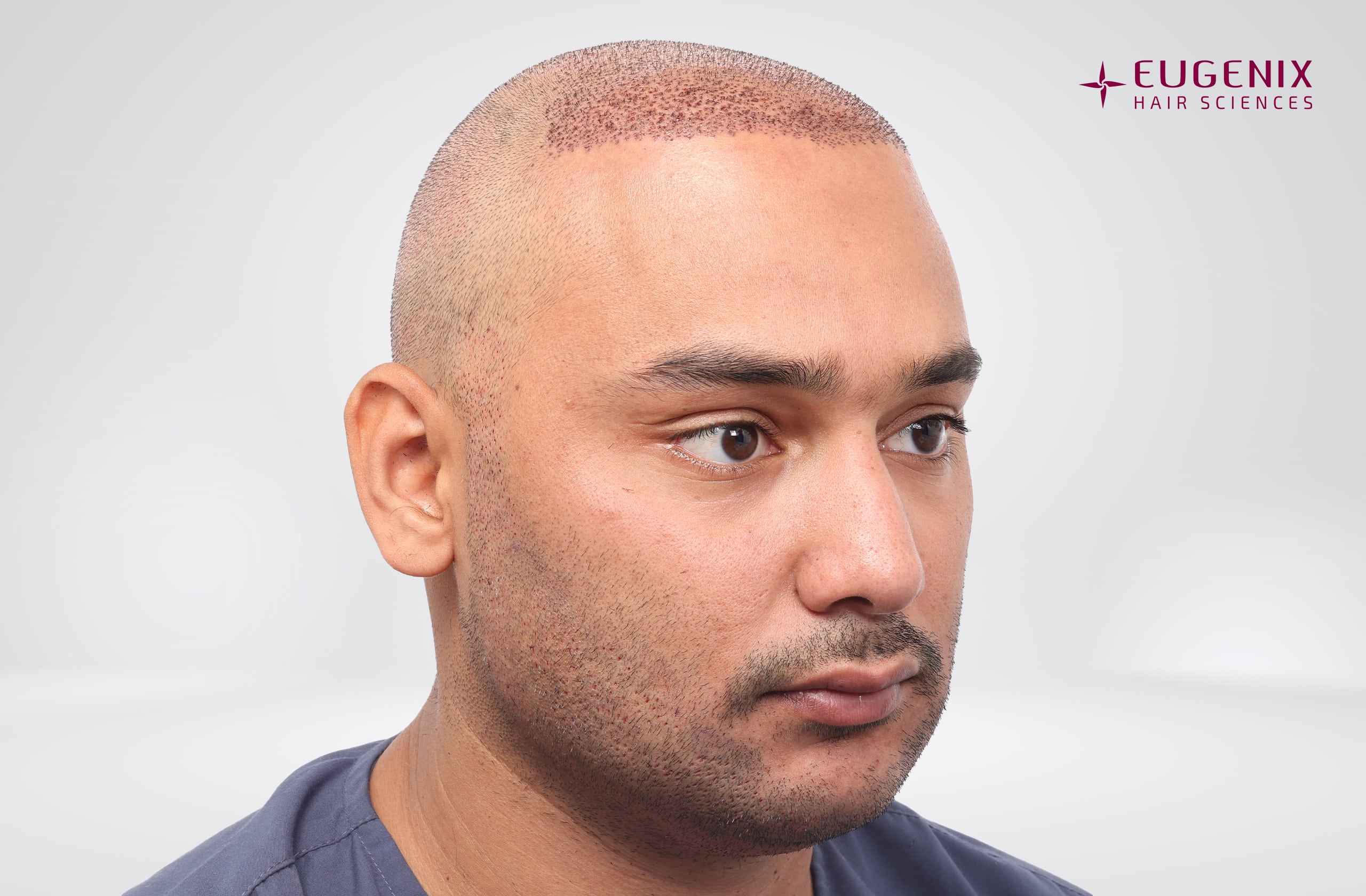 Mohammad Asaduddin Post-op left copy