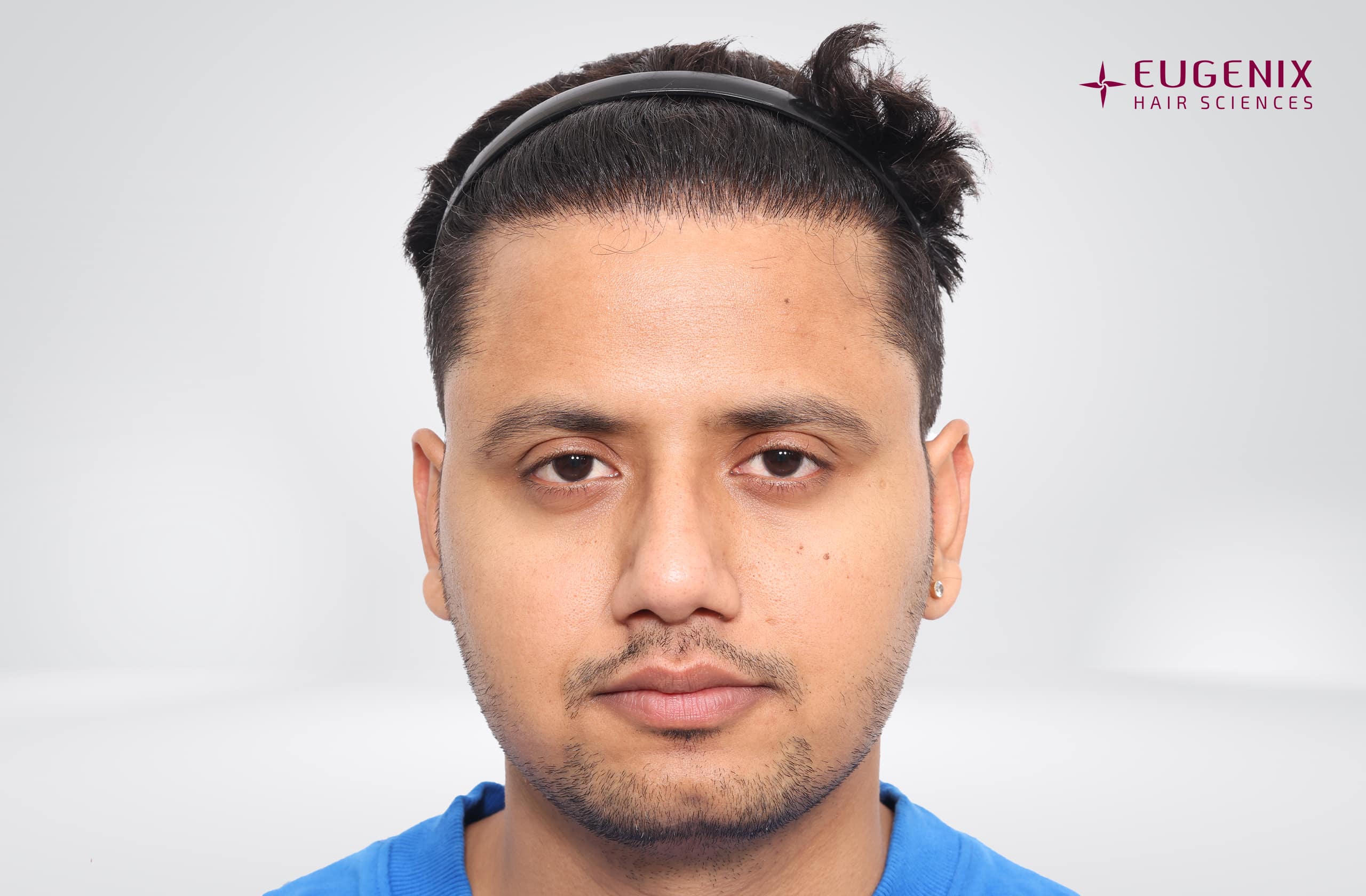 Rajesh Yadav After Front copy
