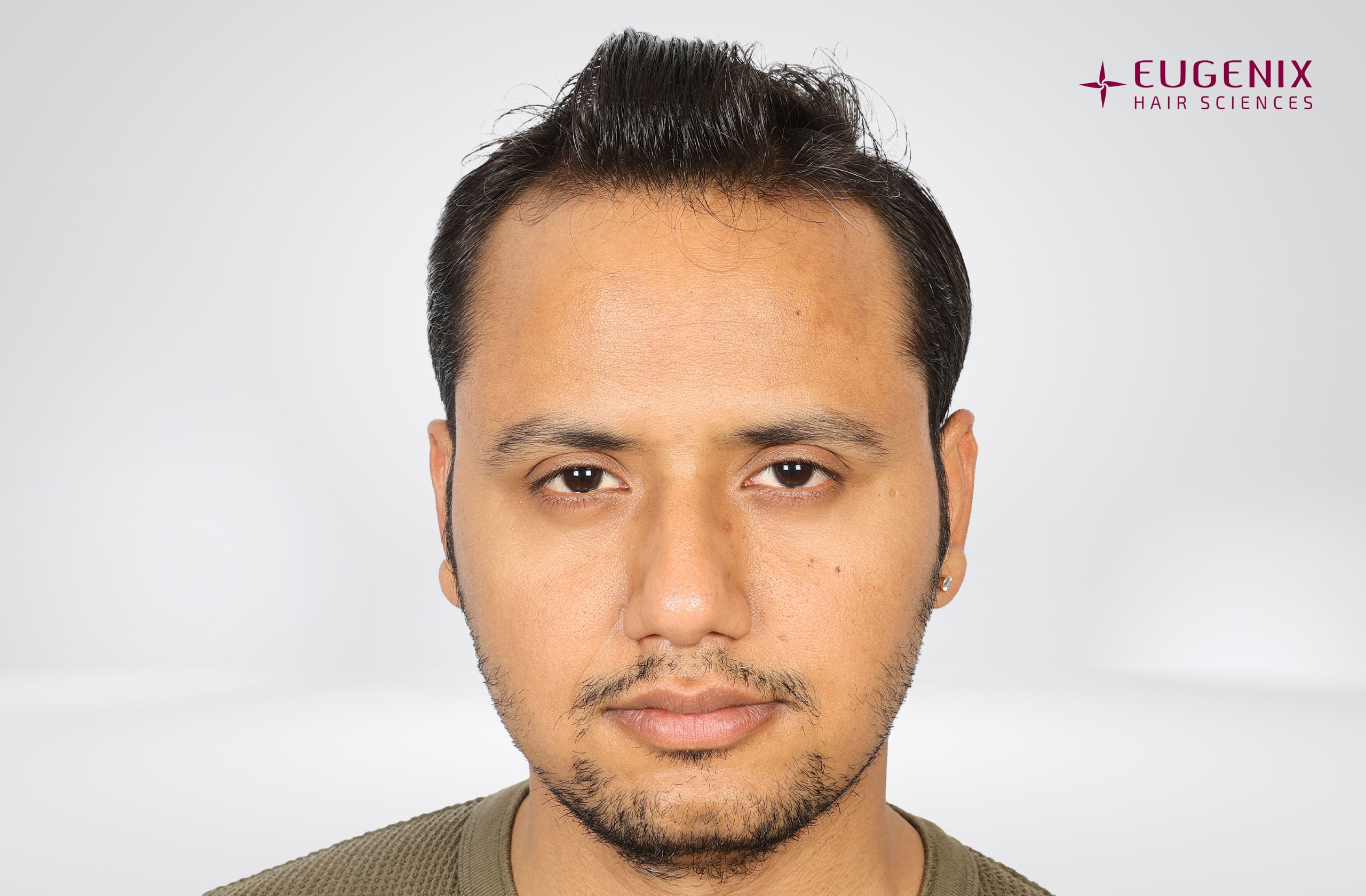 Rajesh Yadav Before Front copy