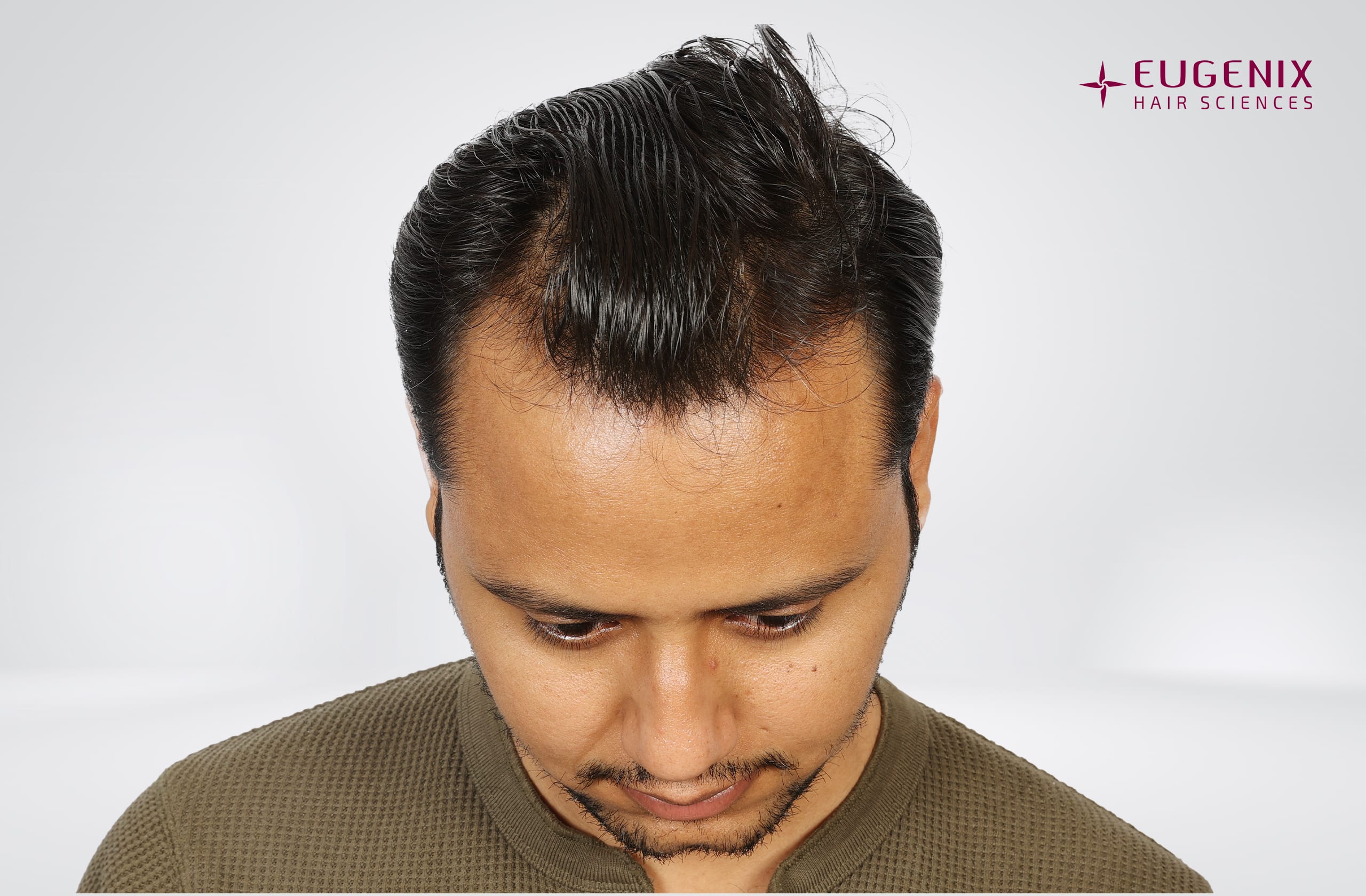 Rajesh Yadav Before Head Down copy