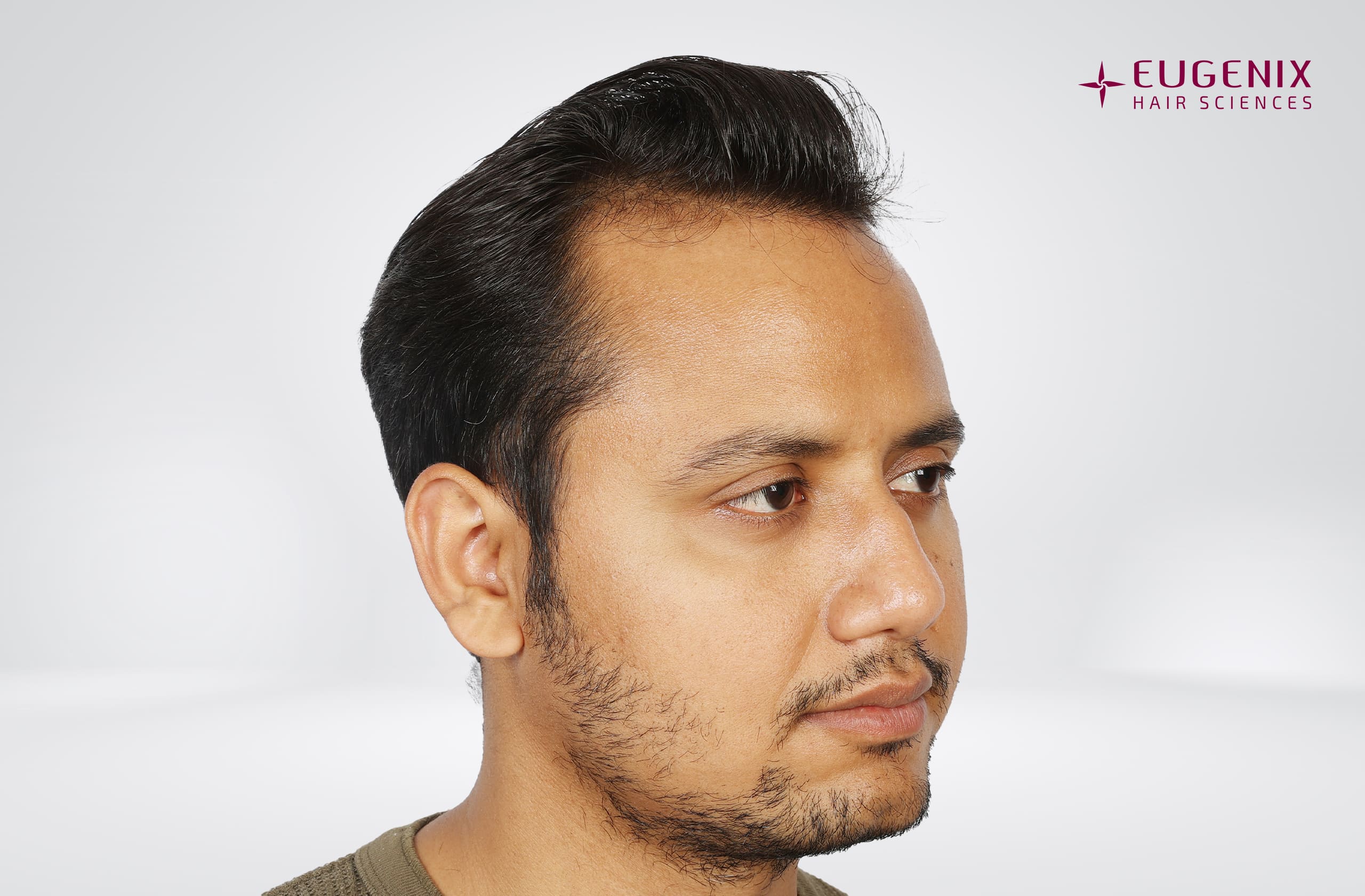 Rajesh Yadav Before Left copy
