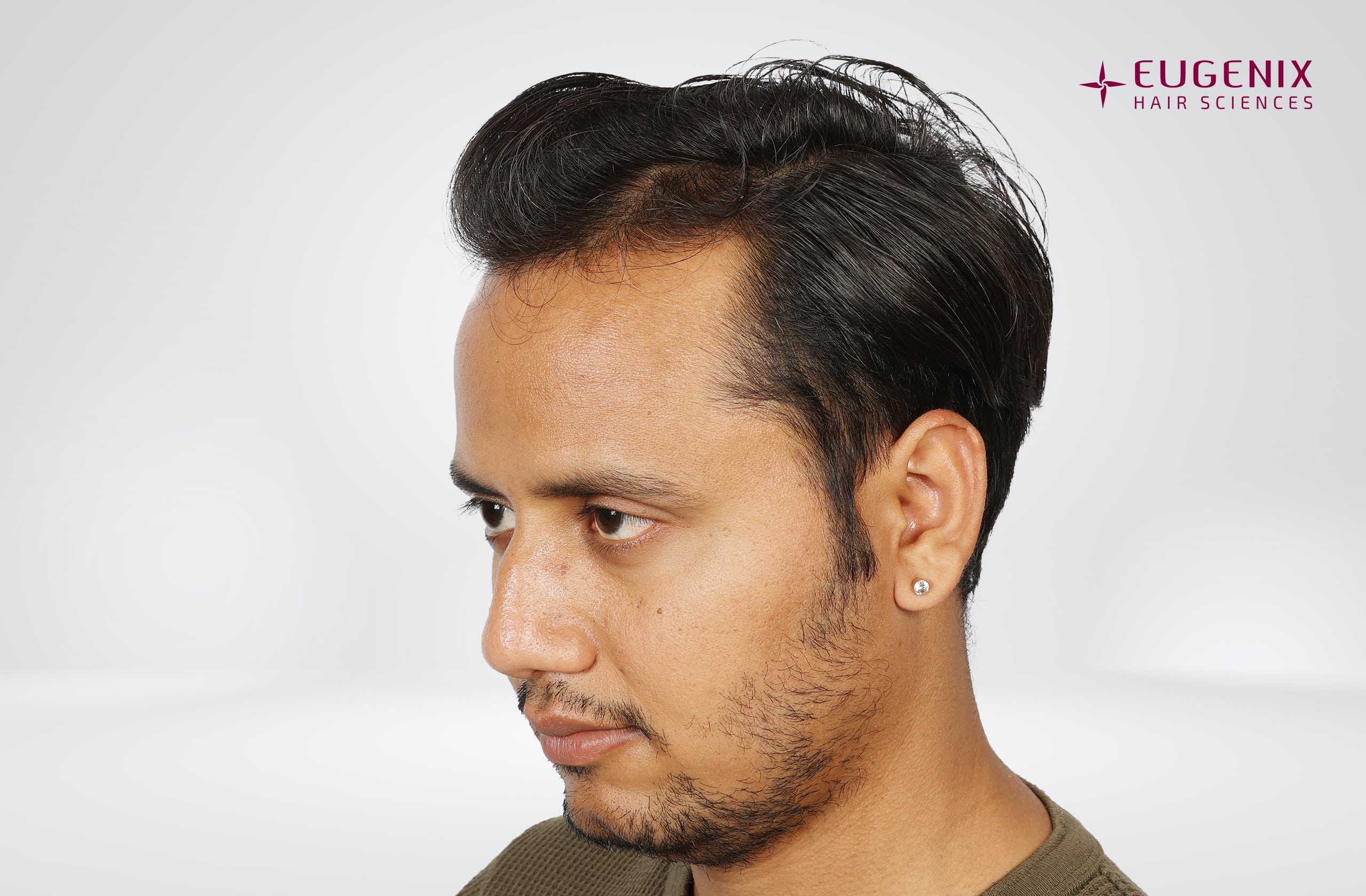 Rajesh Yadav Before Right copy