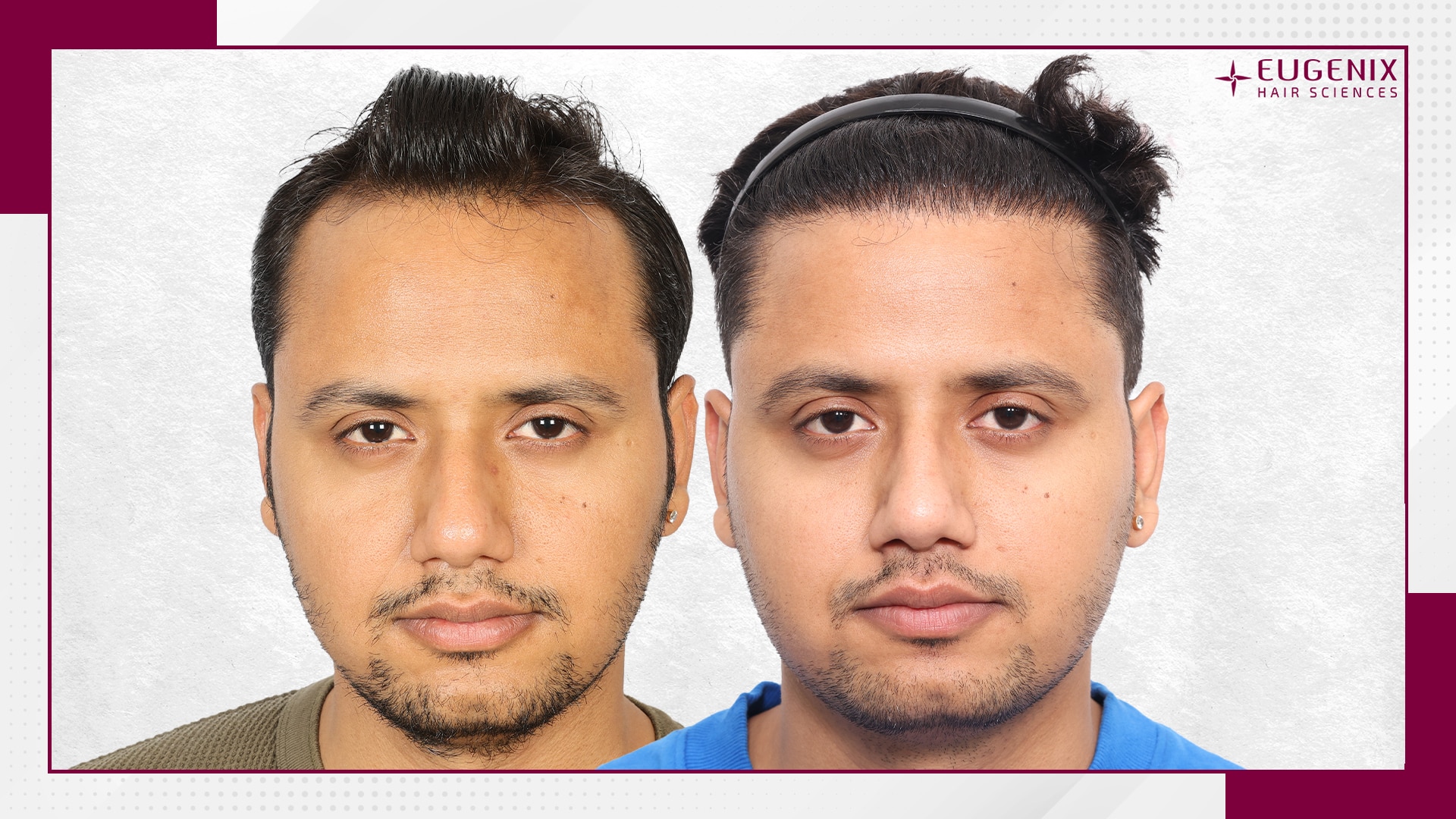Rajesh Yadav Front Before and After copy