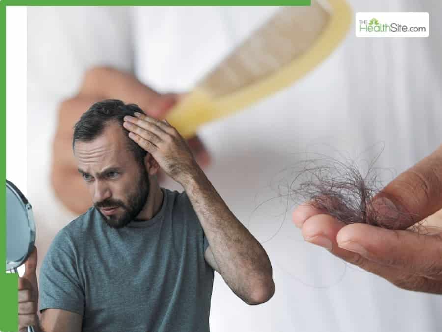 Male-Alopecia-Treatment-Hair-Loss-Is-Progressive-But-Preventable-How-To-Manage-Baldness-Before-Its-Too-Late