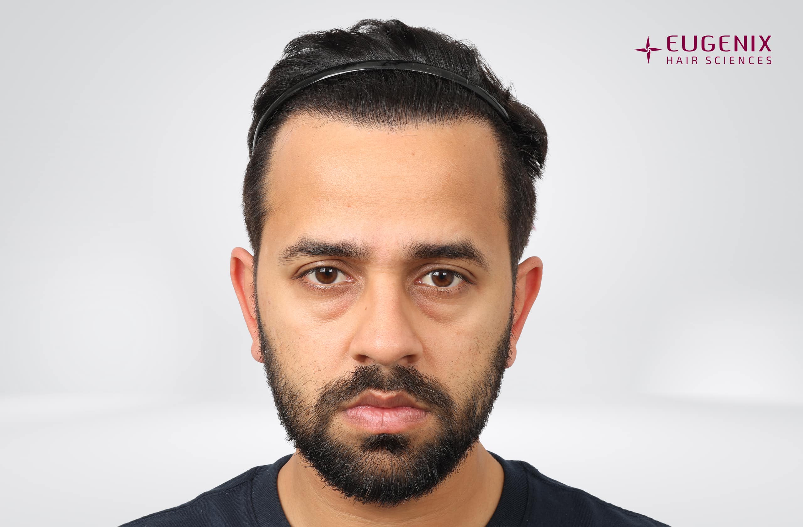 Mihir Gandhi After Front copy