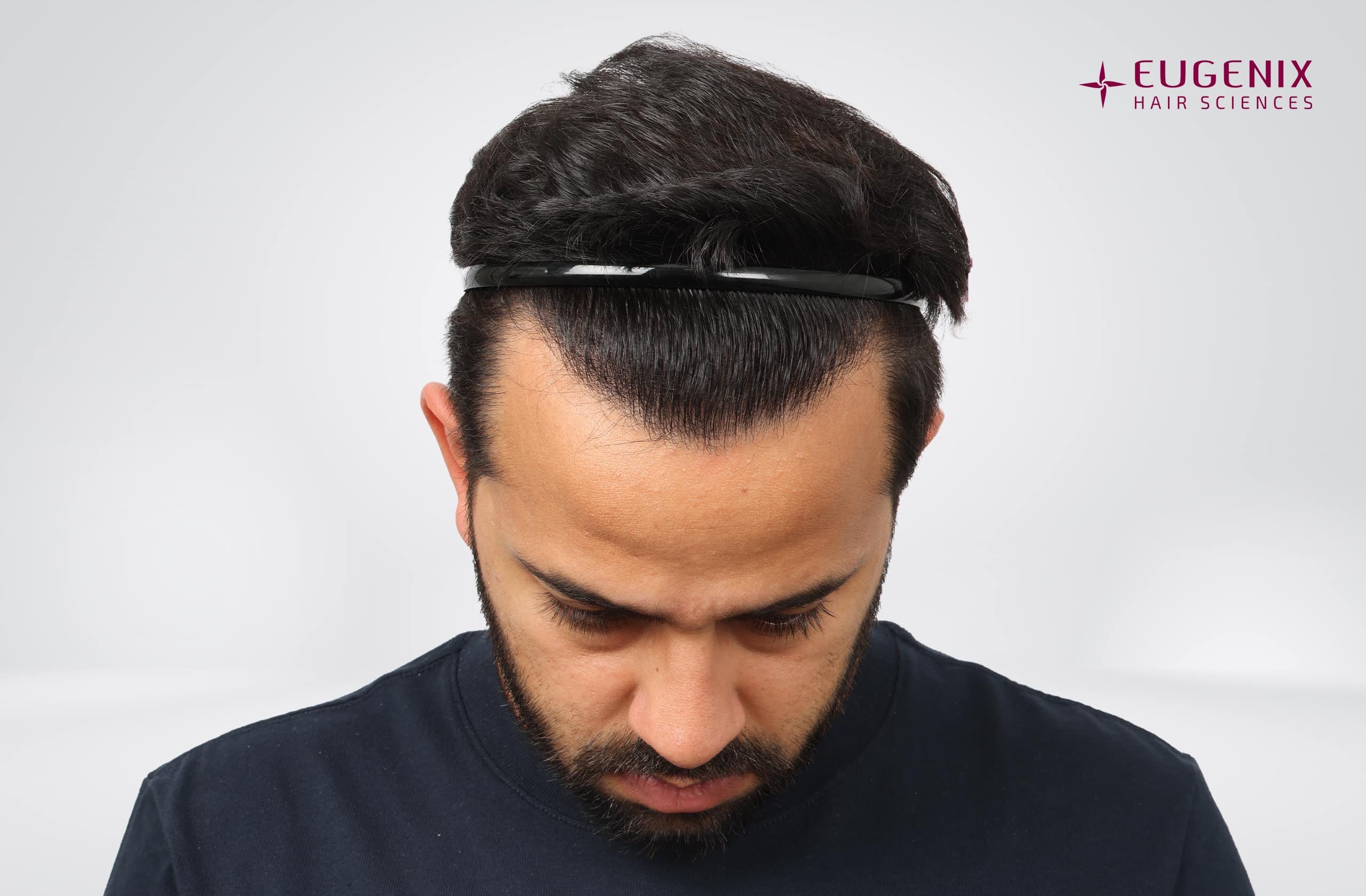 Mihir Gandhi After Head Down copy