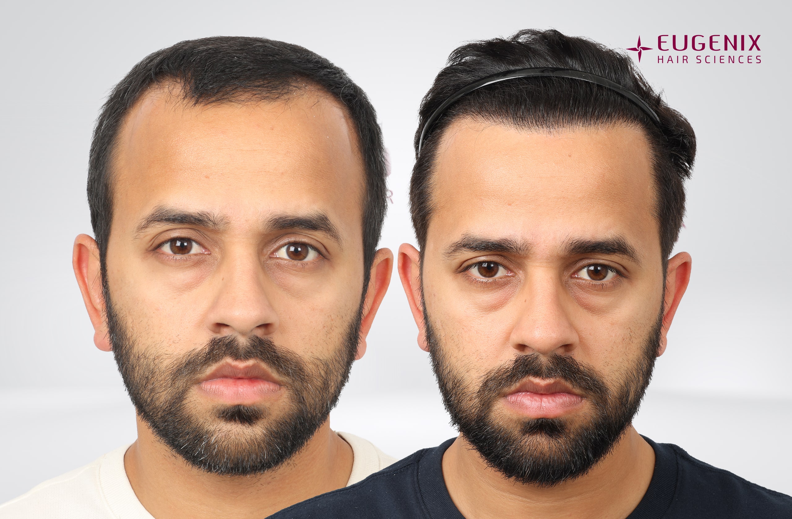 Mihir Gandhi After and Before Front copy