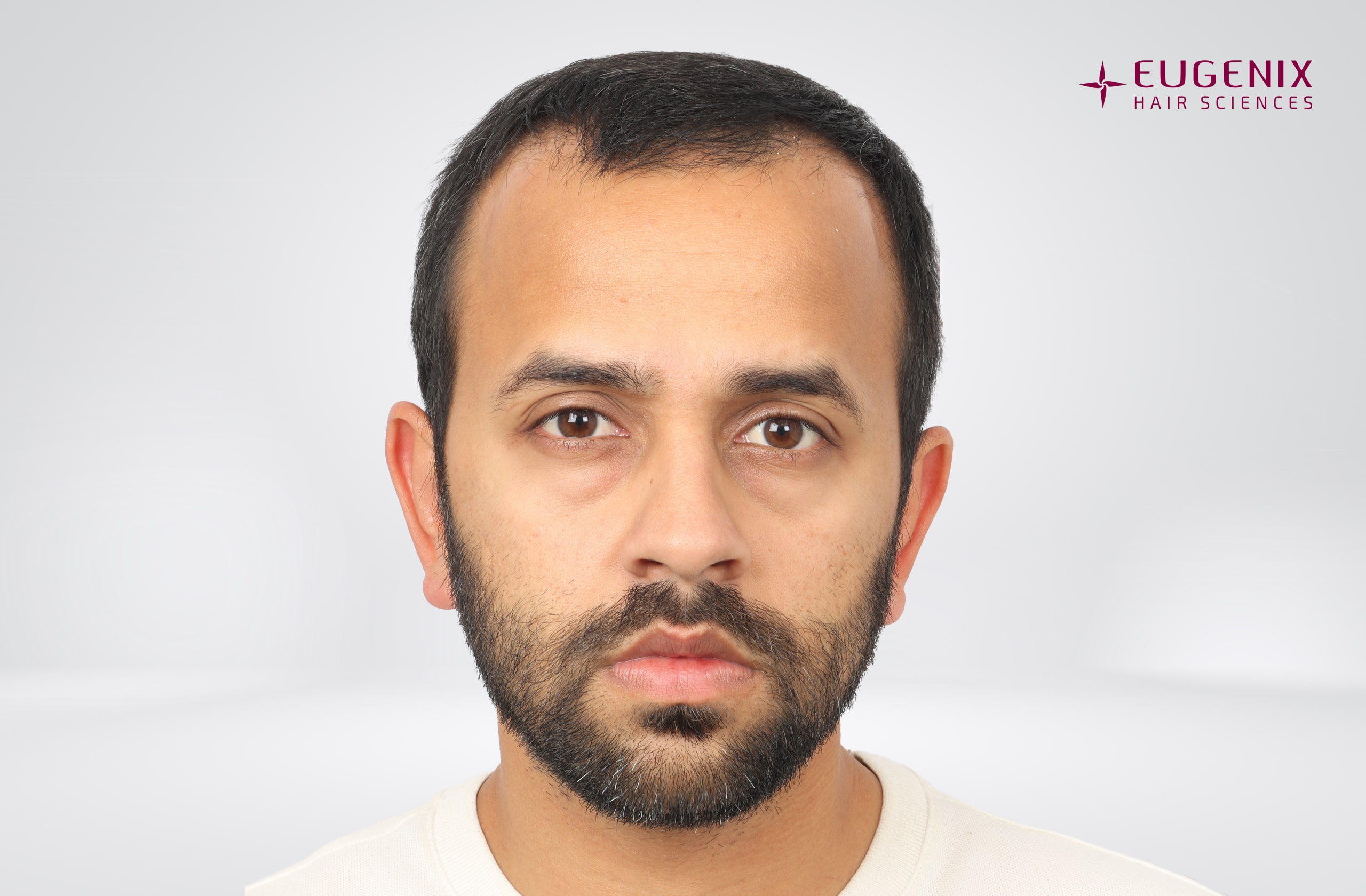 Mihir Gandhi Before Front copy