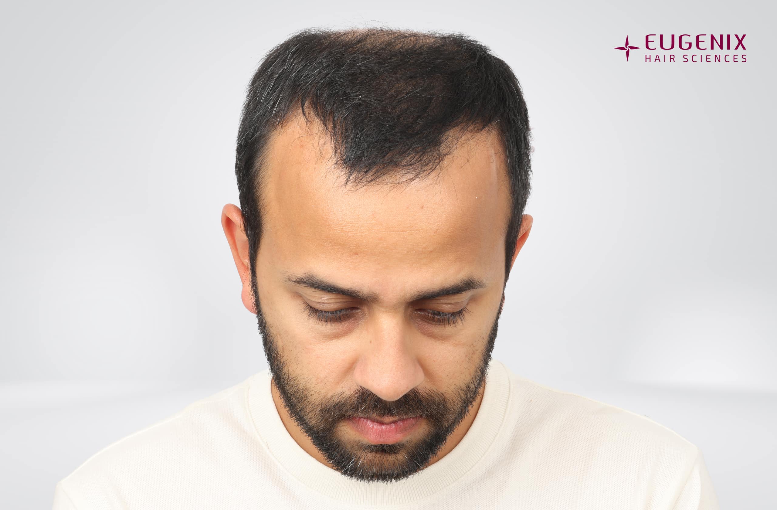 Mihir Gandhi Before Head Dowm copy