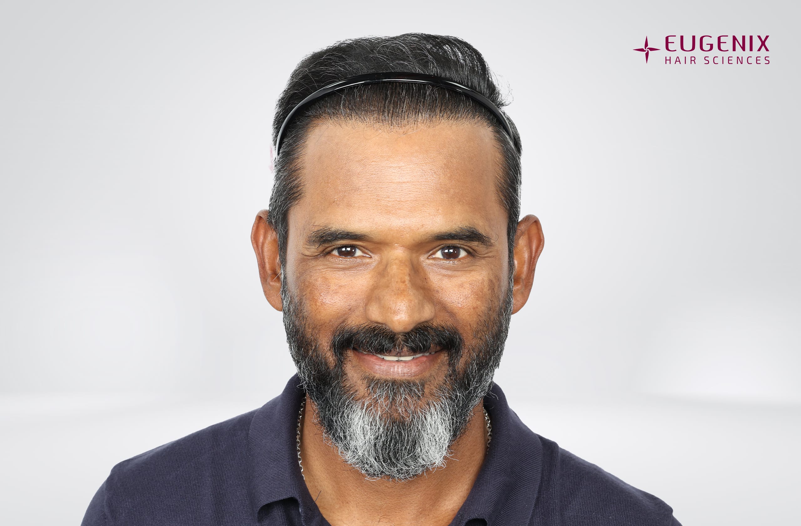 R Sridhar Front After