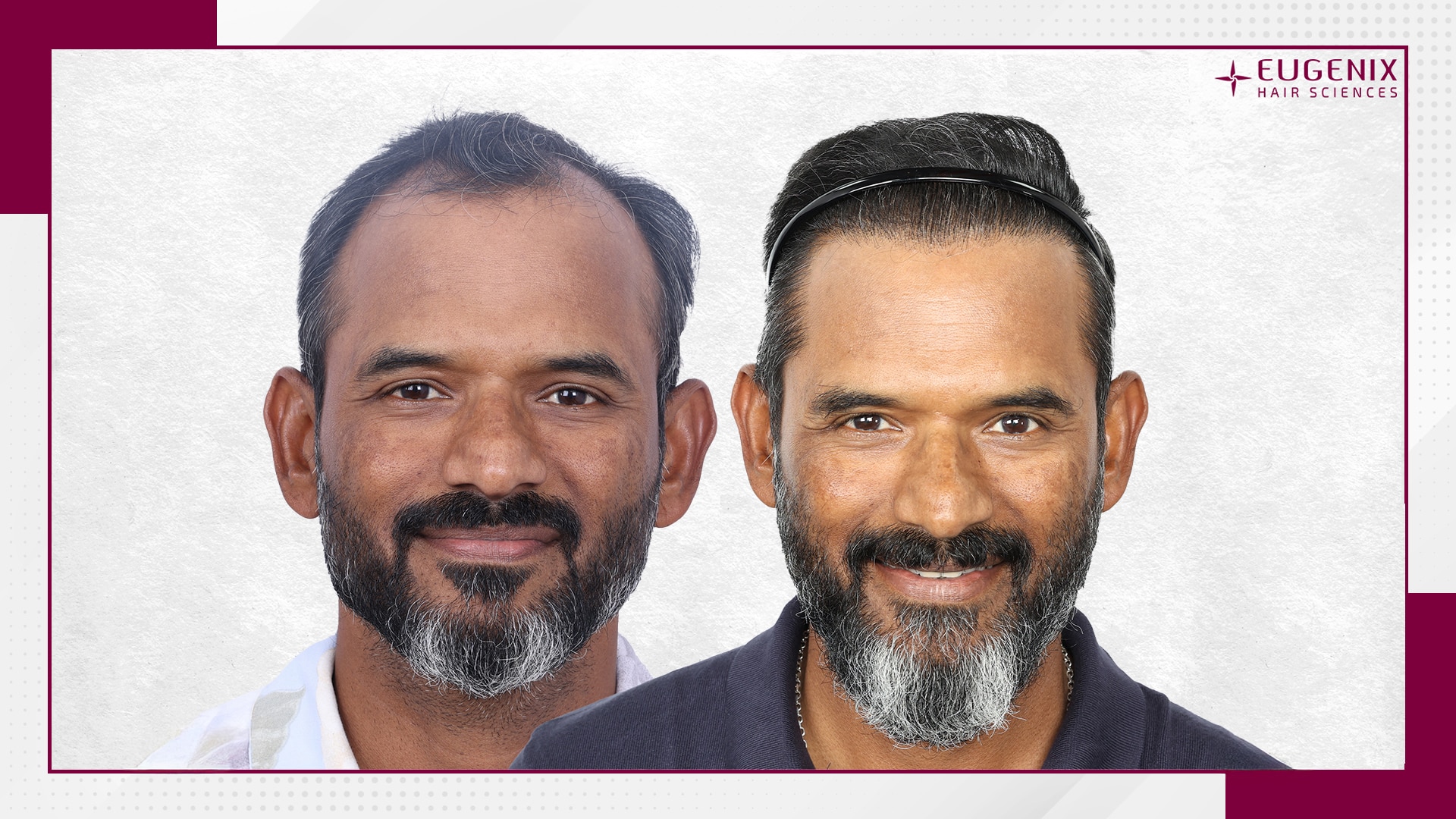 R Sridhar Front Before & After copy