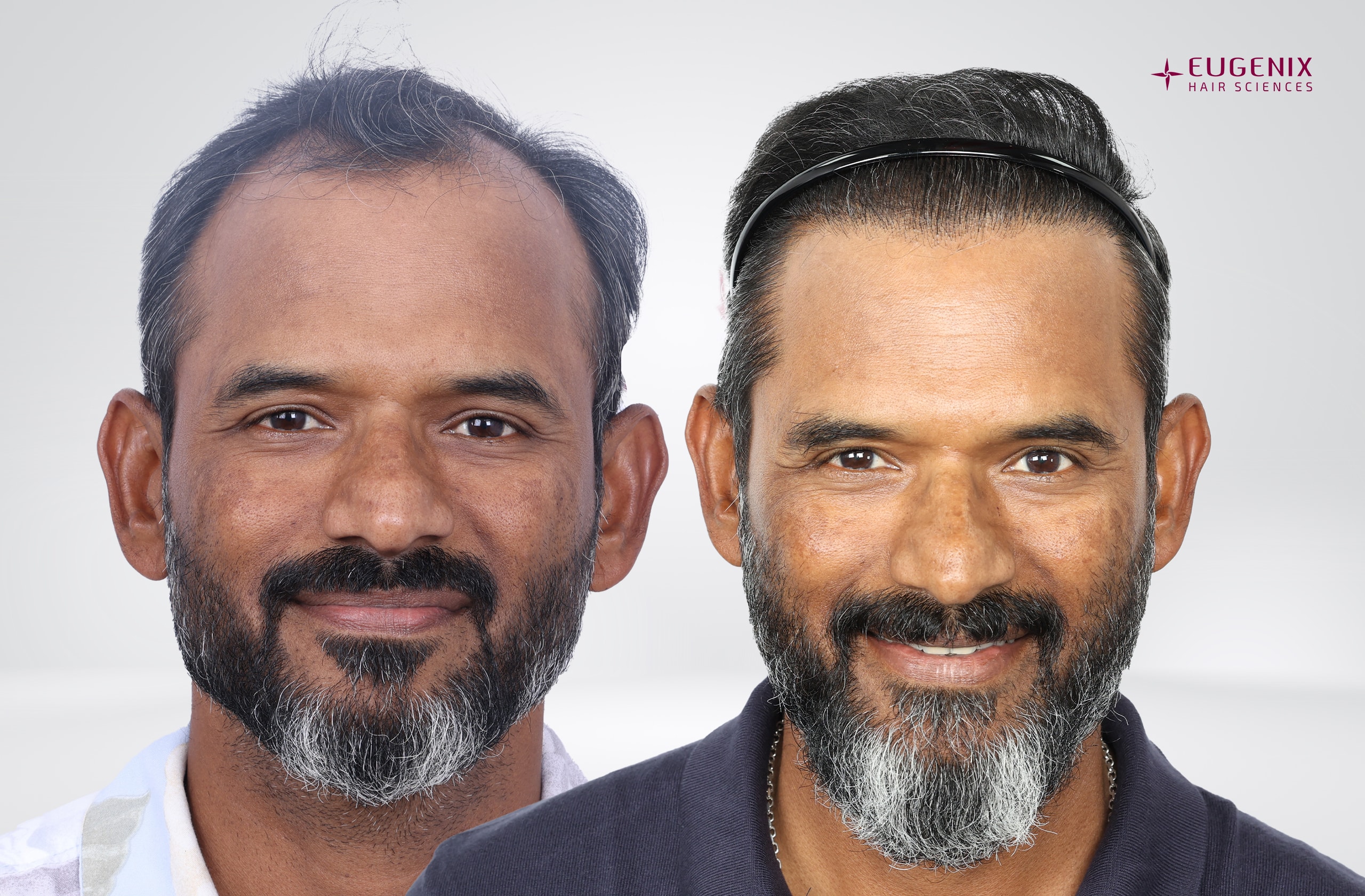R Sridhar Front Before After