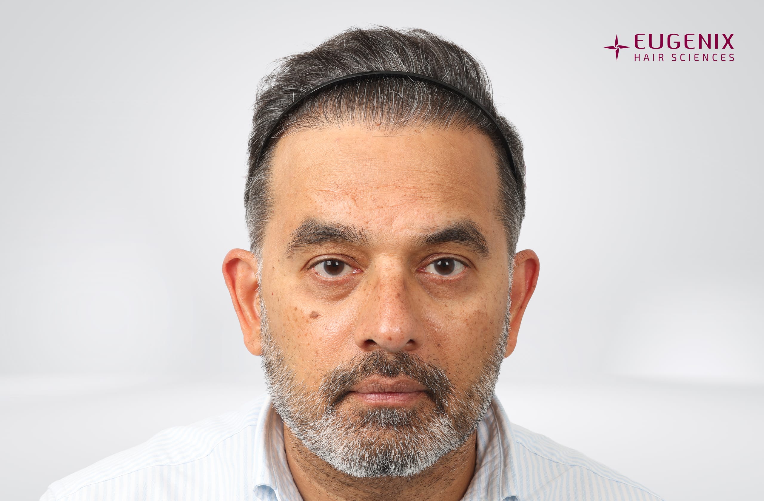 SHRAVAN SHROFF After Front copy