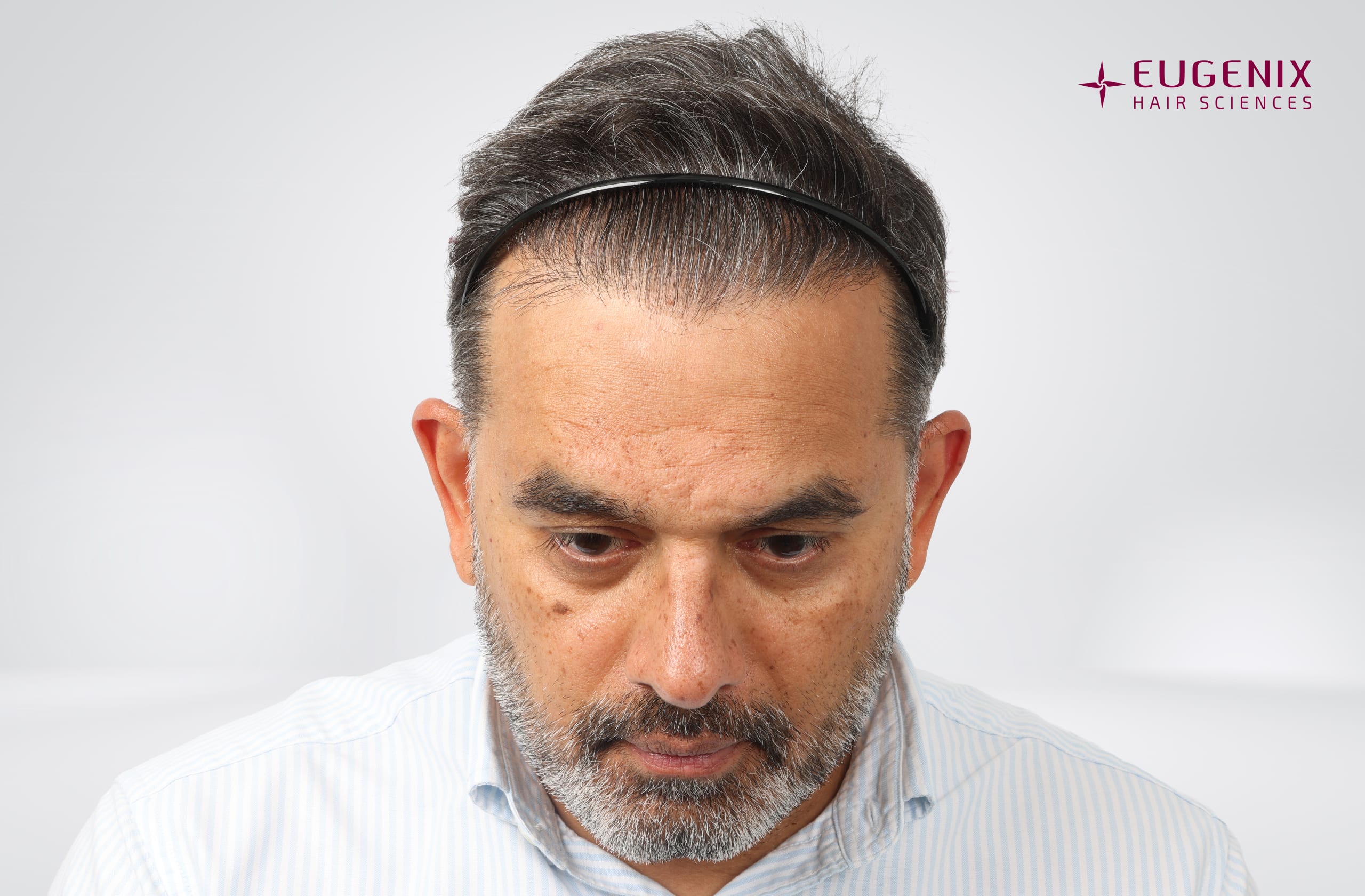 SHRAVAN SHROFF After Head Down copy