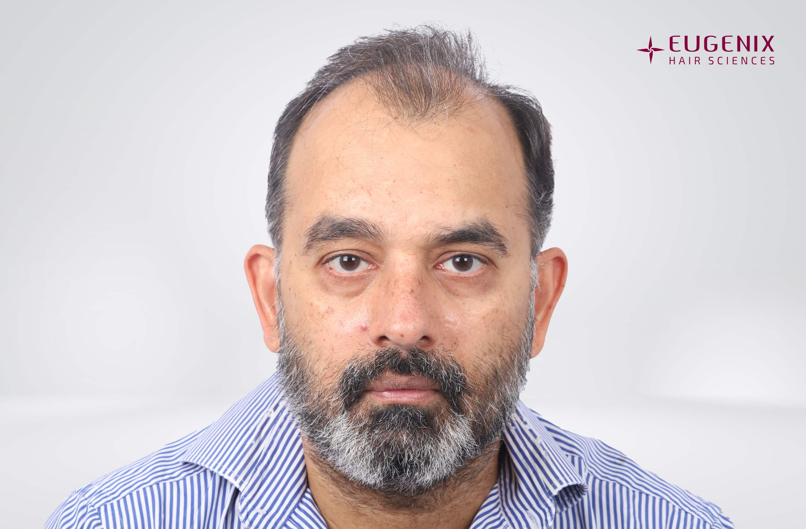 SHRAVAN SHROFF Before Front copy