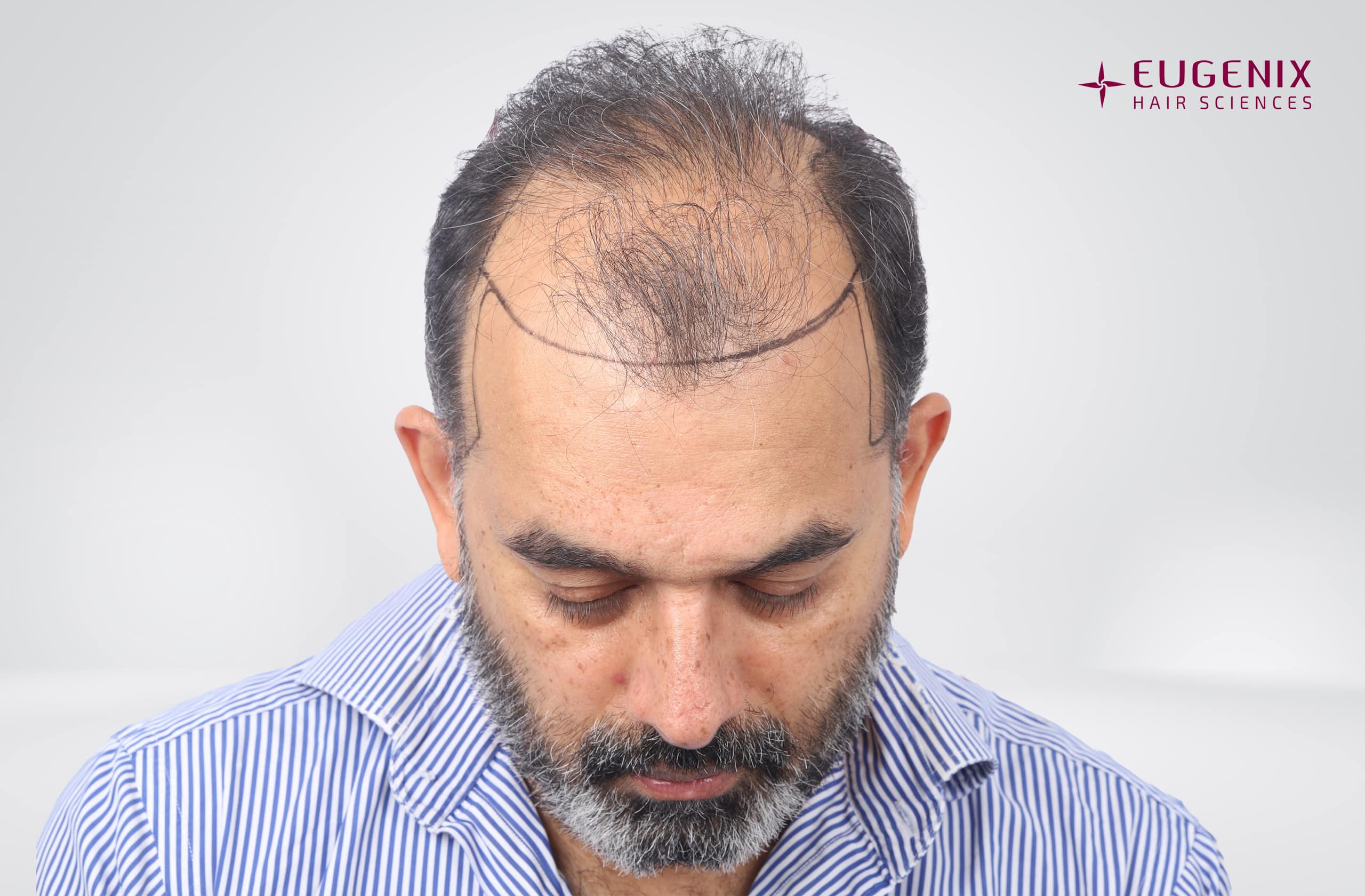 SHRAVAN SHROFF Planning Head Down copy