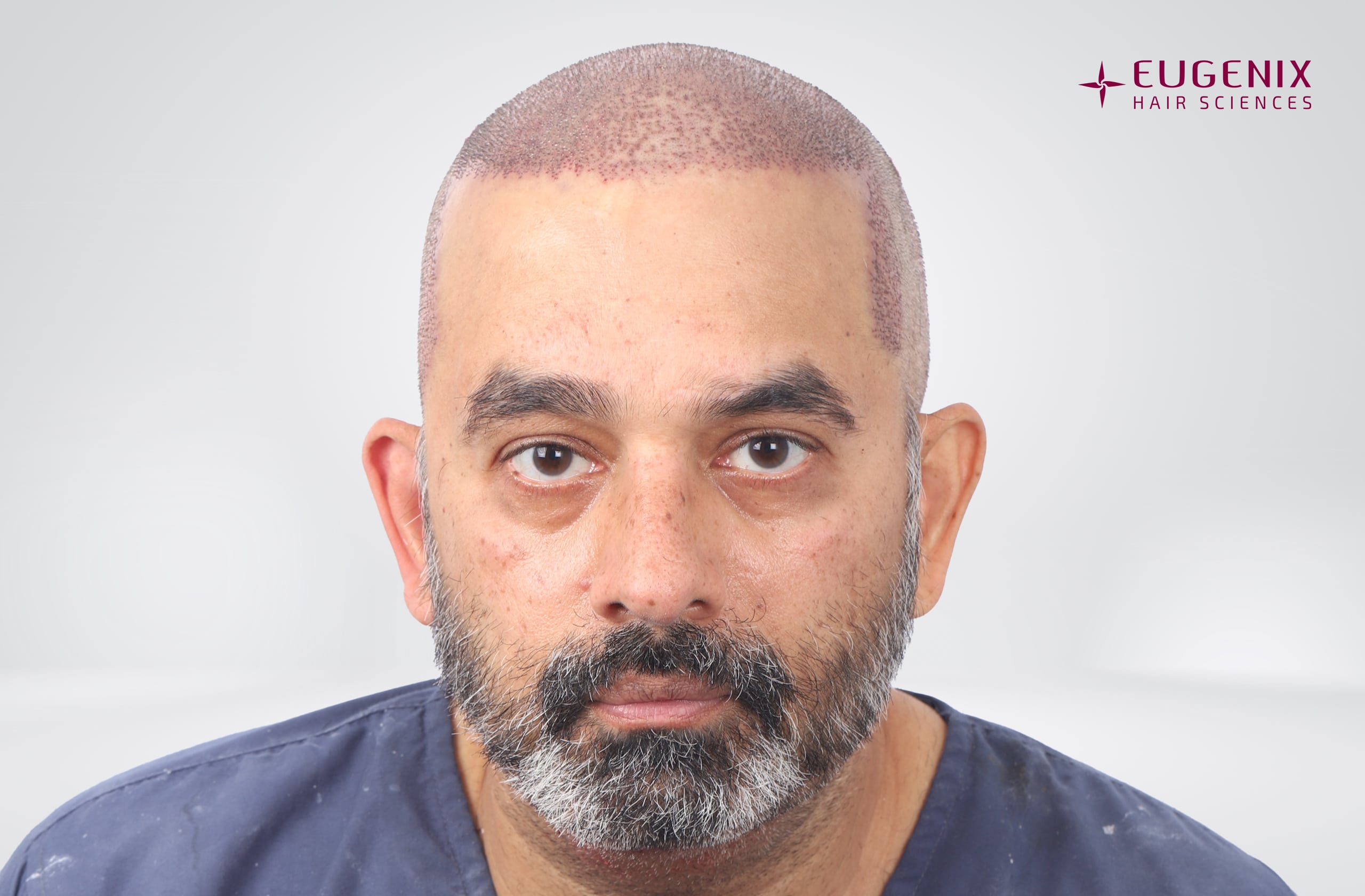 SHRAVAN SHROFF Post-op Front copy