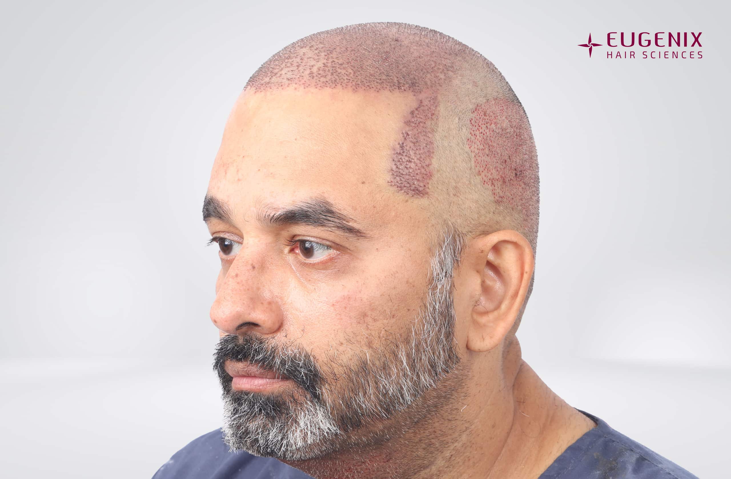 SHRAVAN SHROFF Post-op Right copy