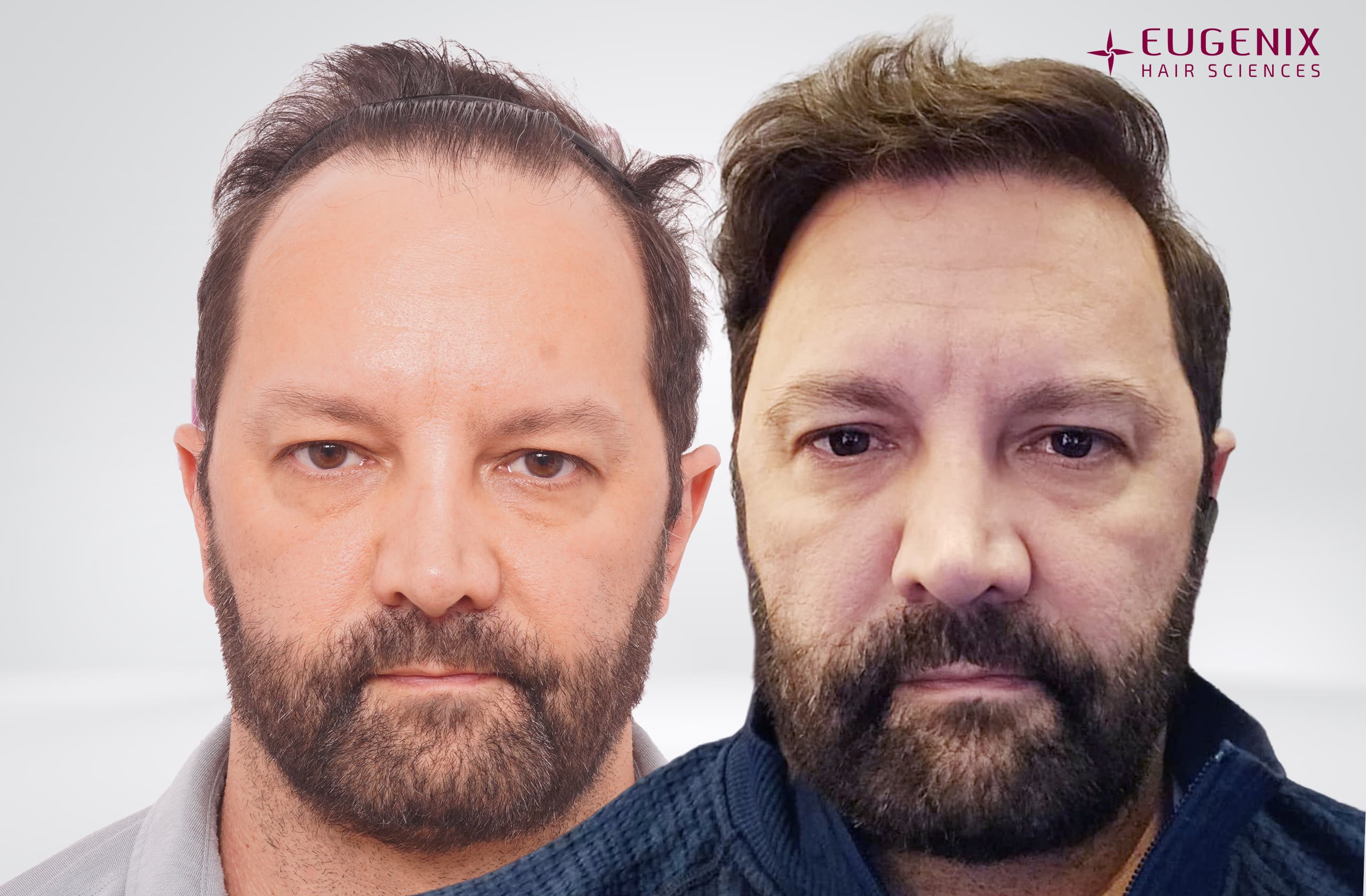 Anthony Monaco Before and After Front copy