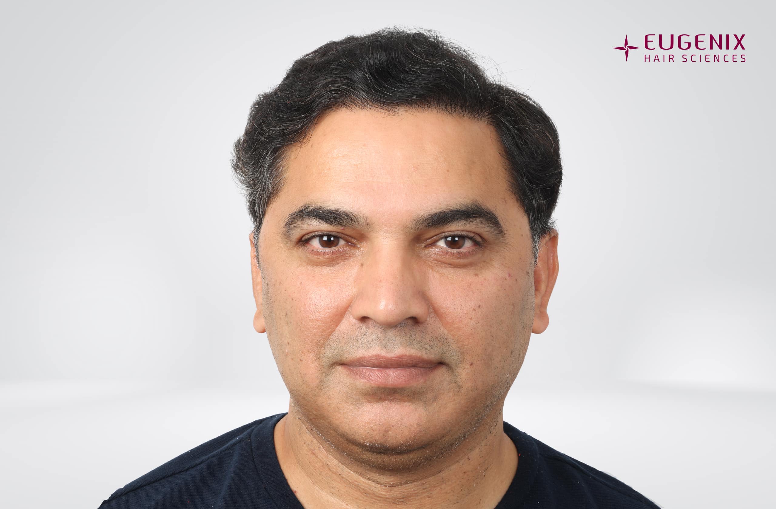Nitin Dubey After Front copy