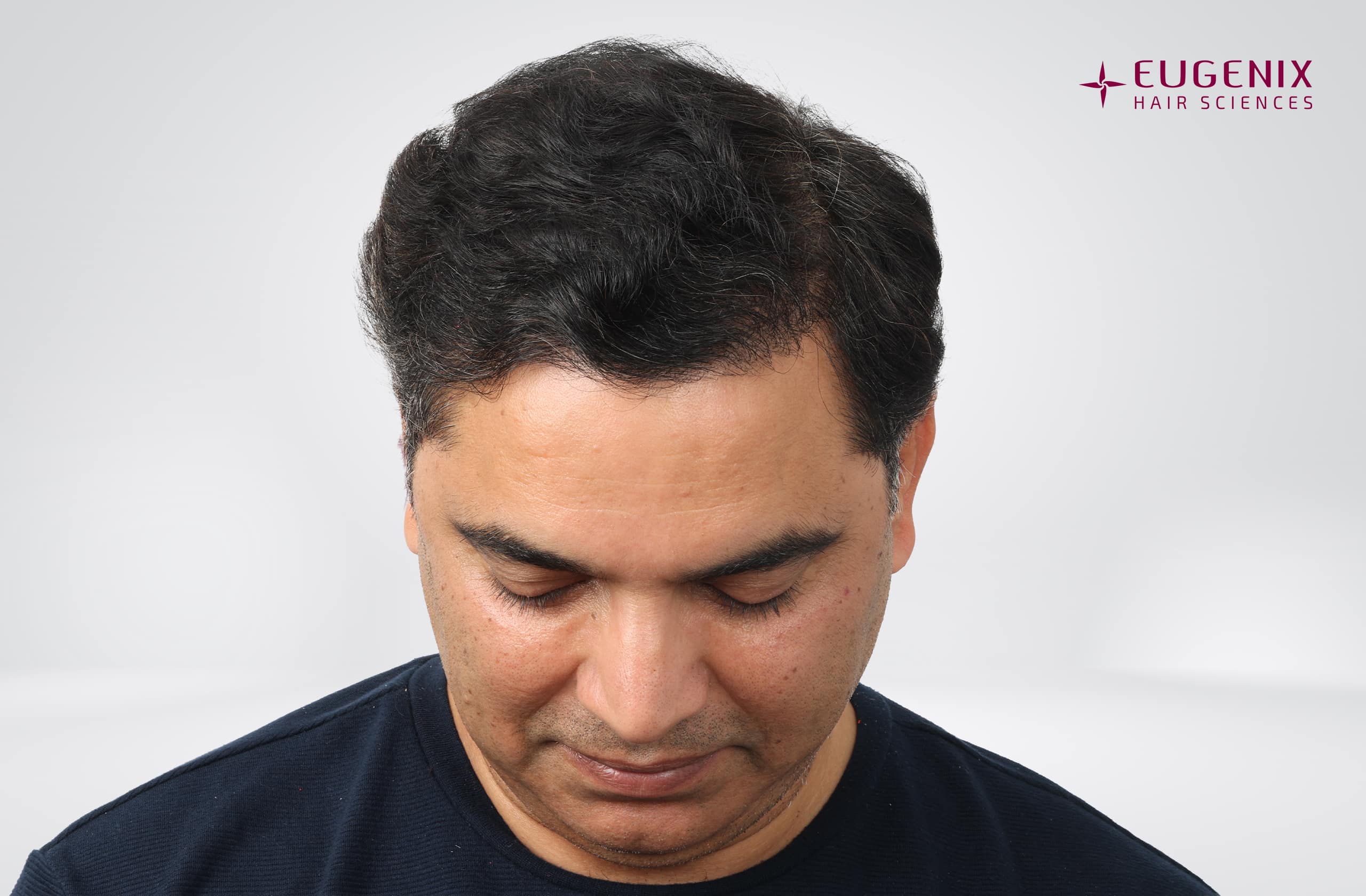 Nitin Dubey After Head Down copy