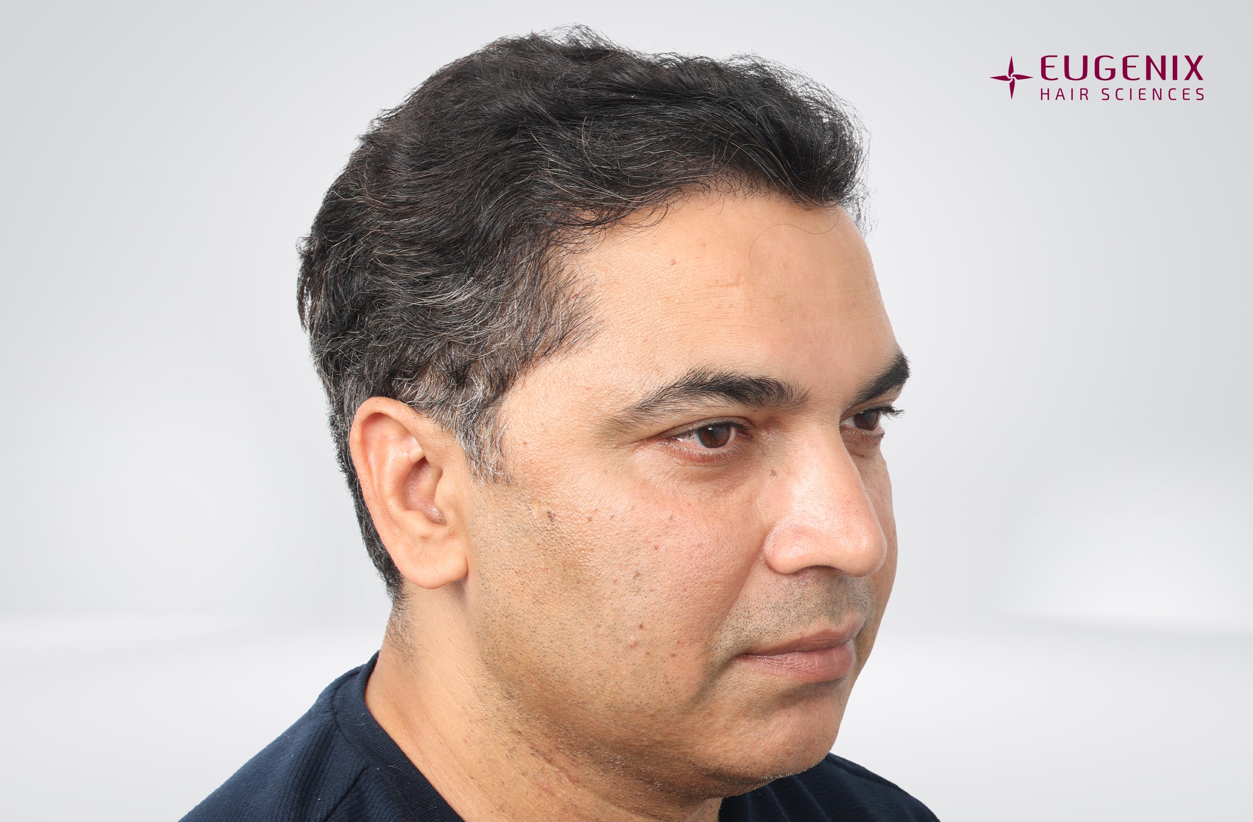 Nitin Dubey After Head Left copy