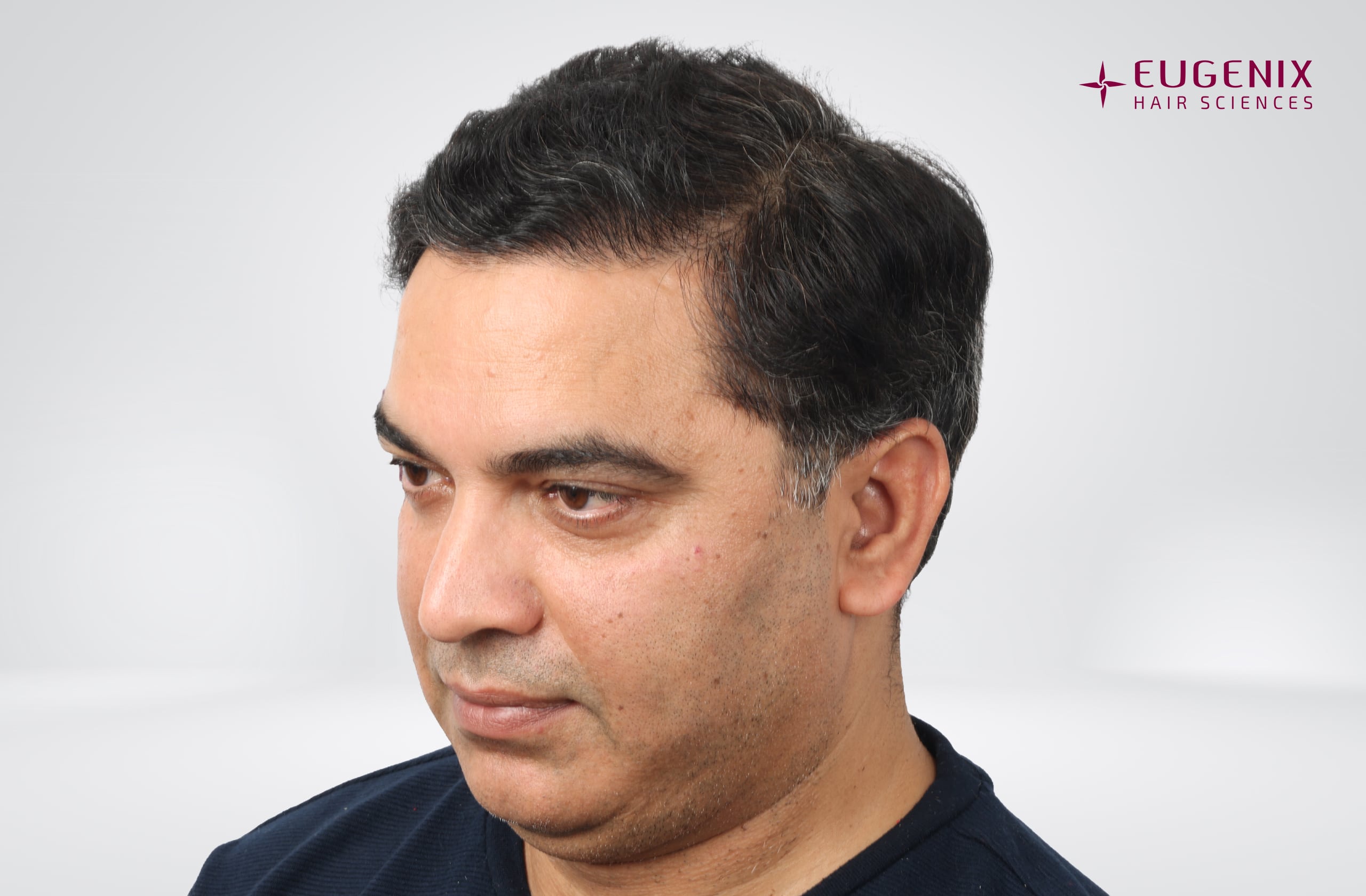 Nitin Dubey After Head Right copy
