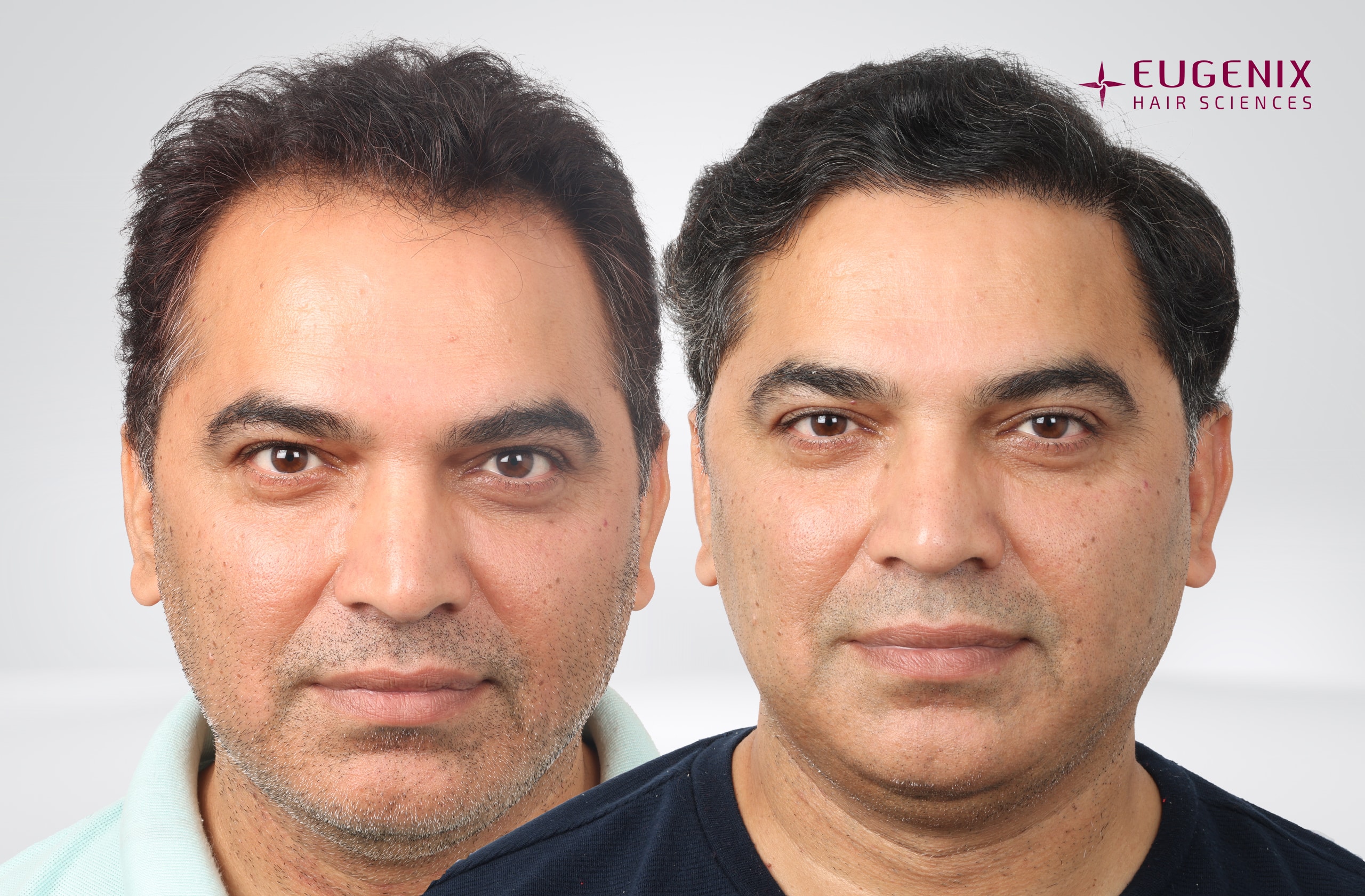 Nitin Dubey After and Before Front copy