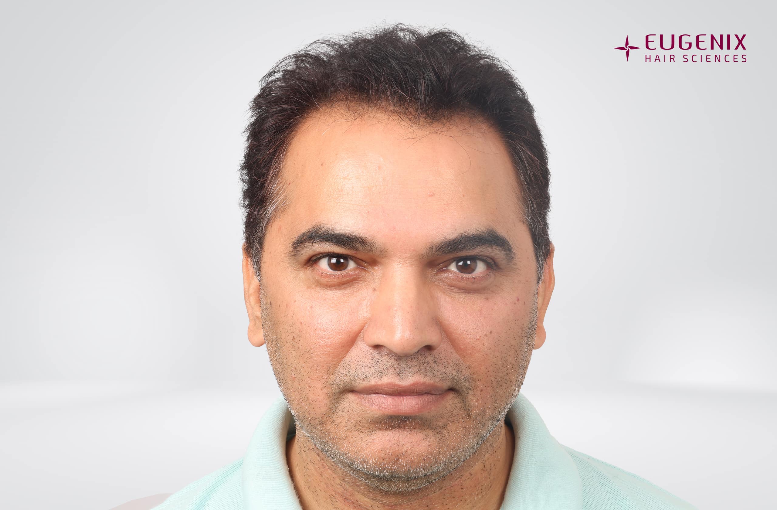 Nitin Dubey Before Front copy