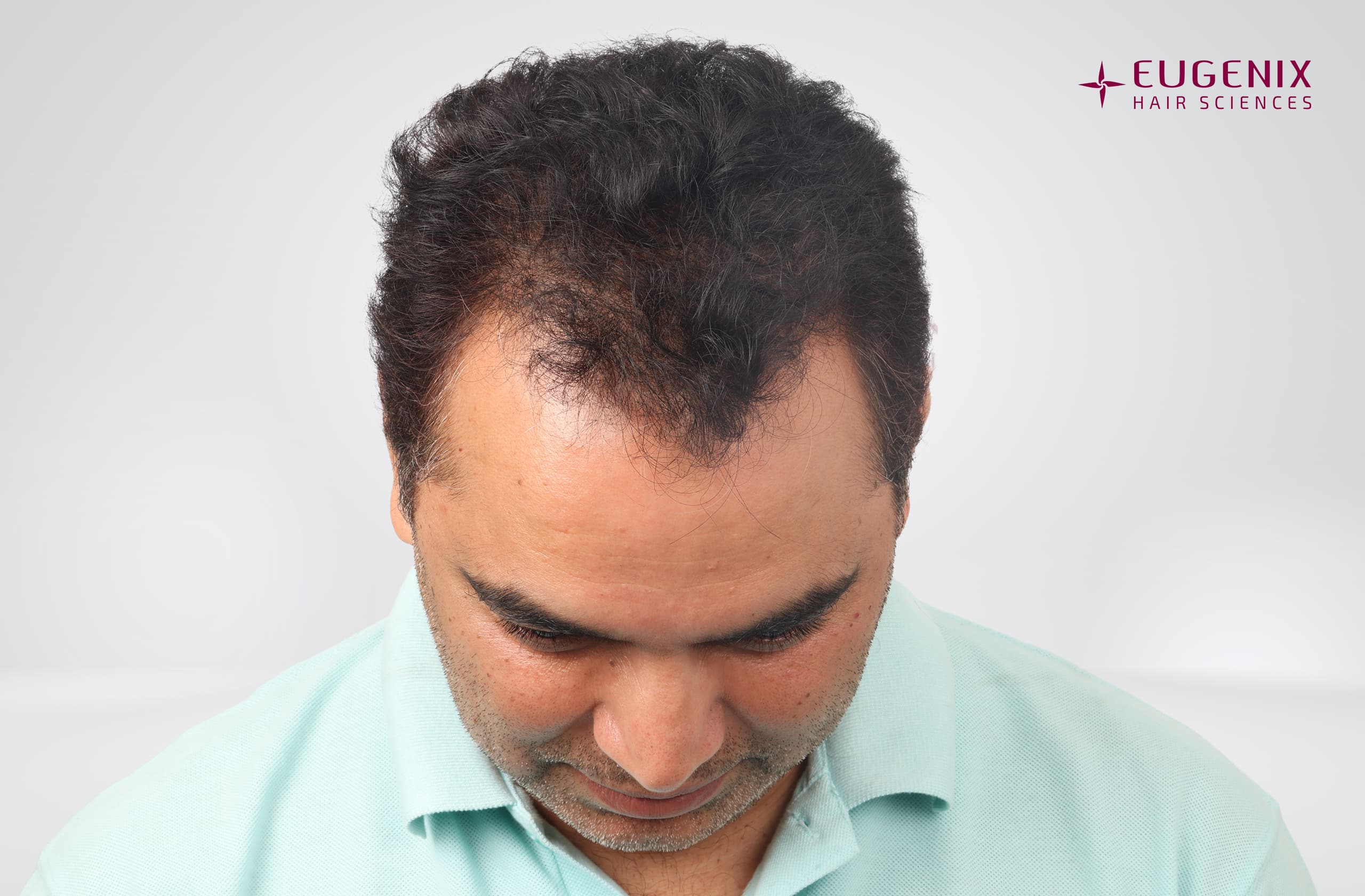 Nitin Dubey Before Head Down copy
