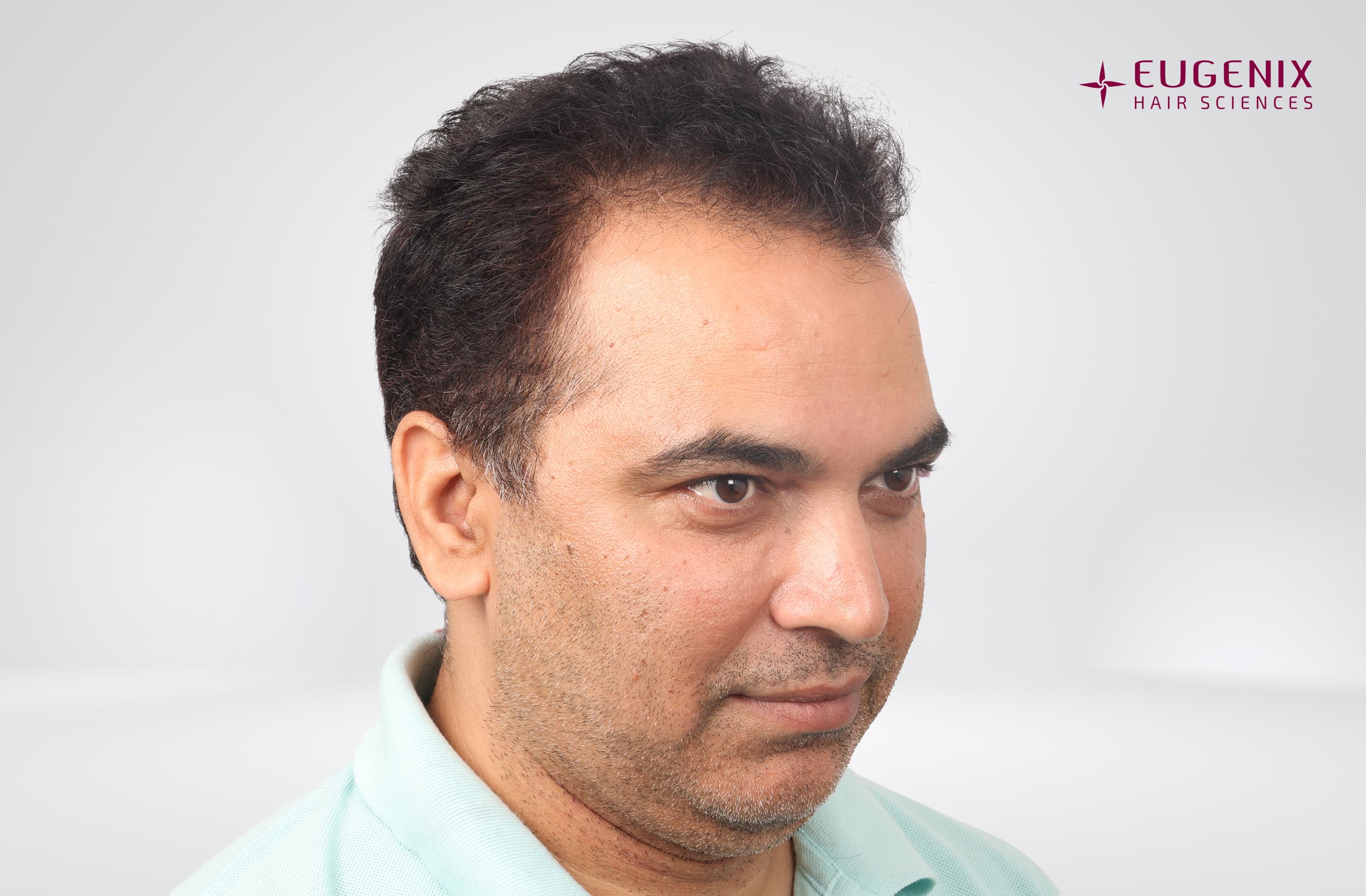 Nitin Dubey Before Left copy