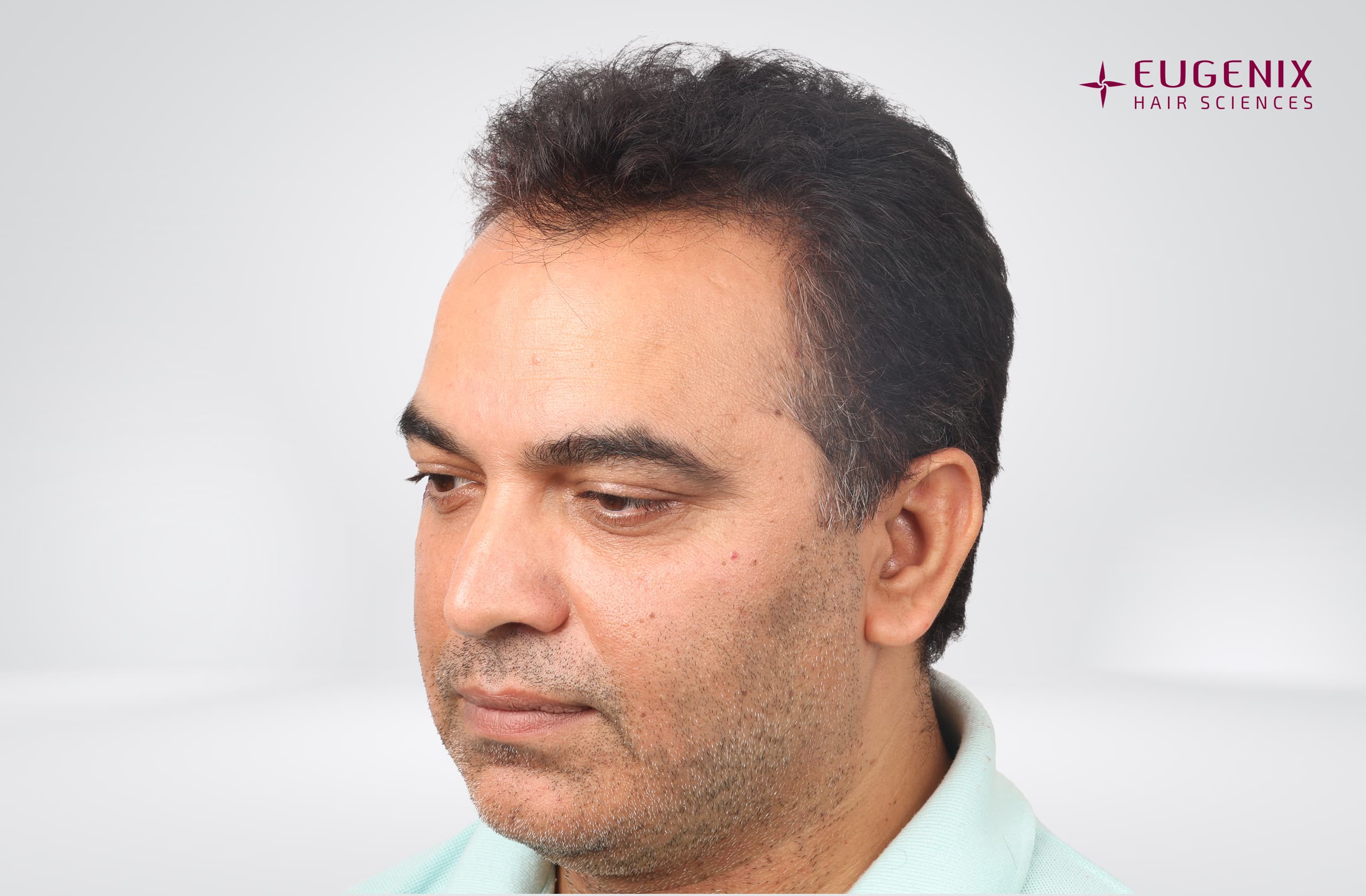 Nitin Dubey Before Right copy
