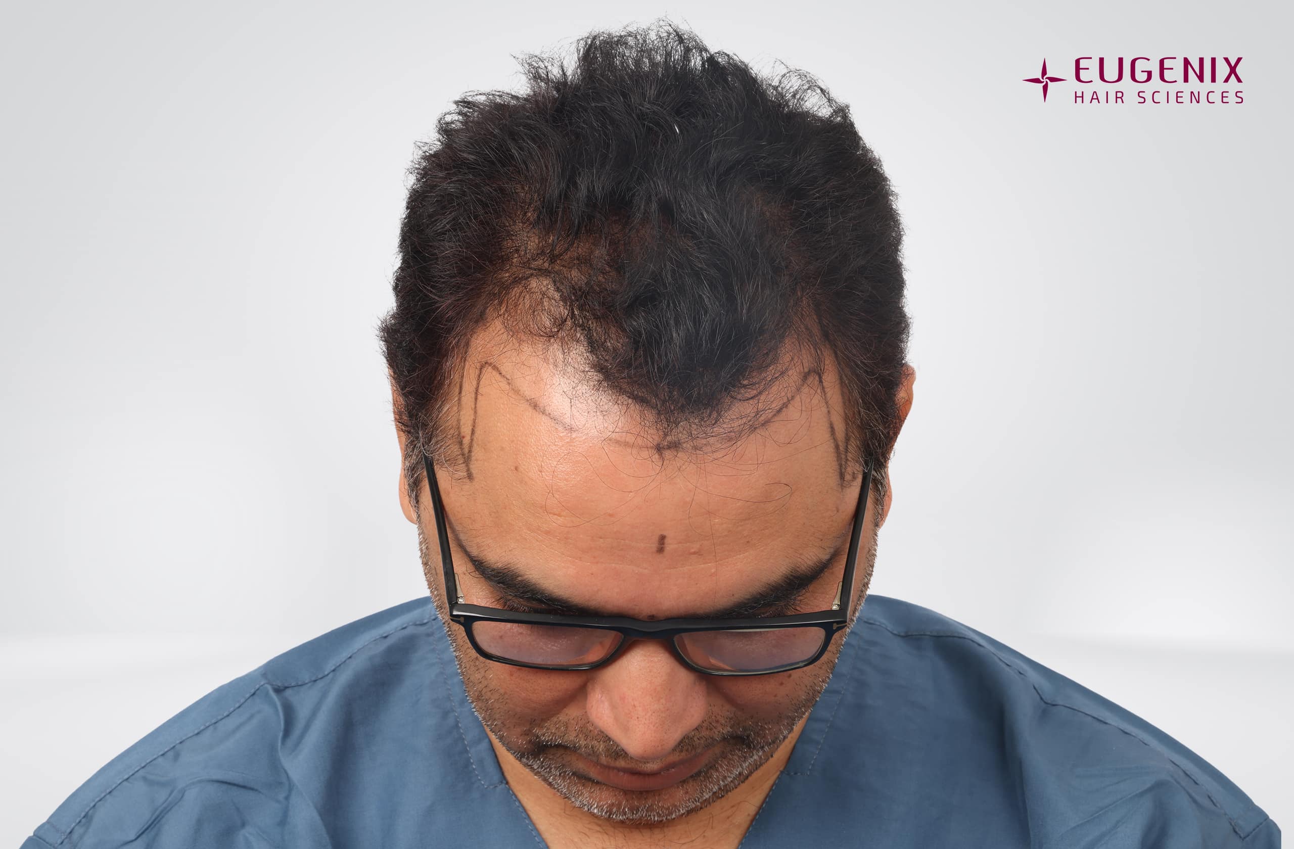 Nitin Dubey Planning Head Down copy