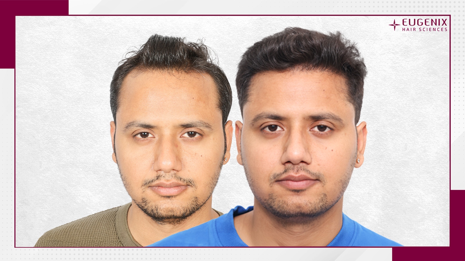 Standard Before & After