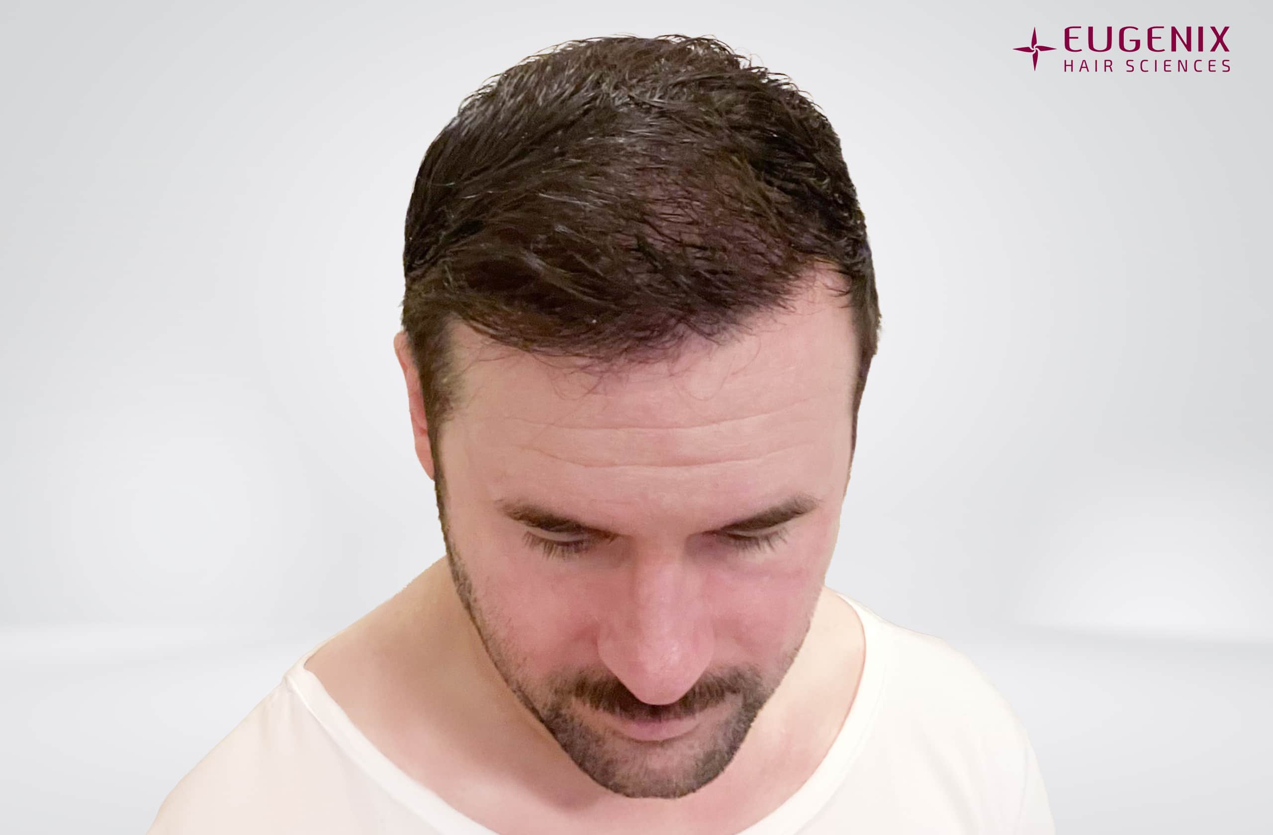 Thomas Wood After Head Down copy