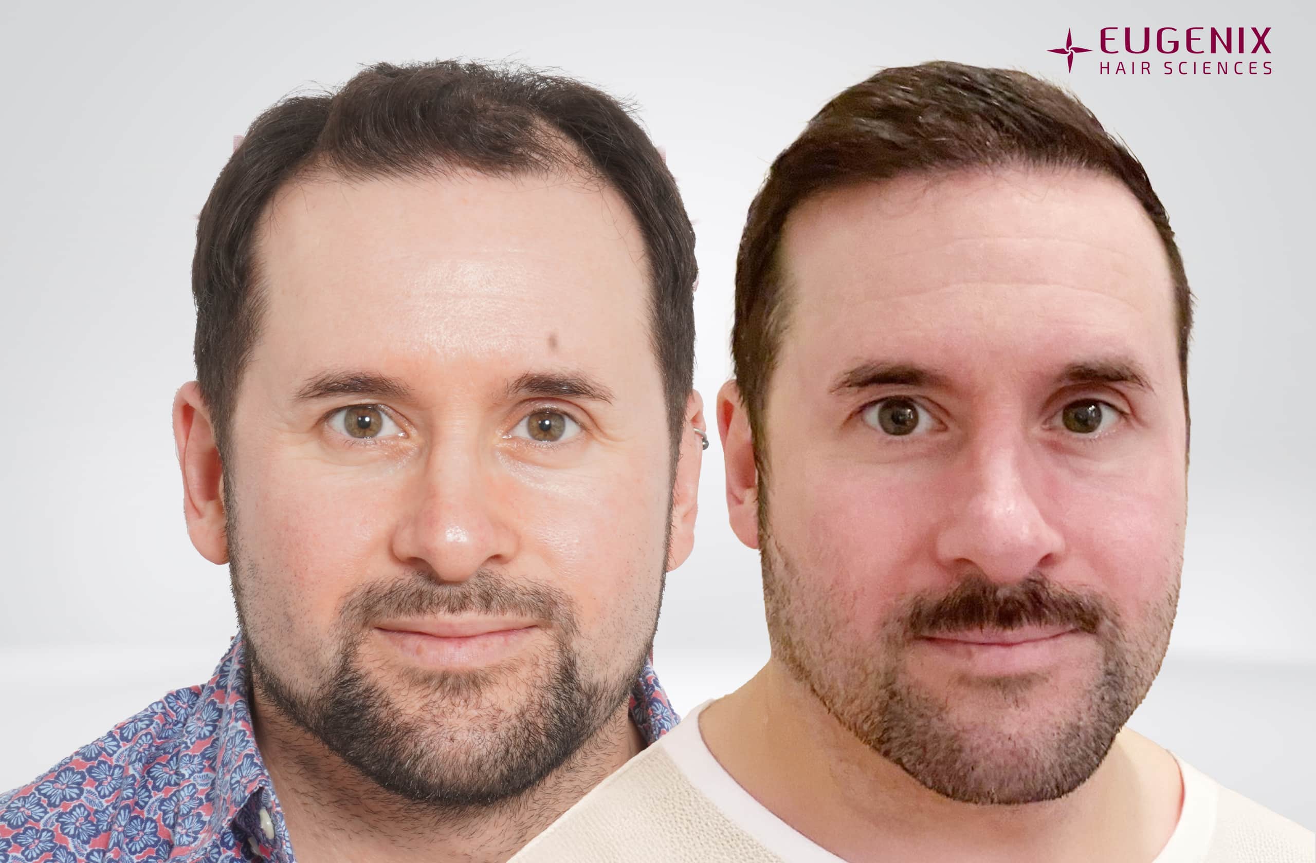 Thomas Wood Before & After Front copy