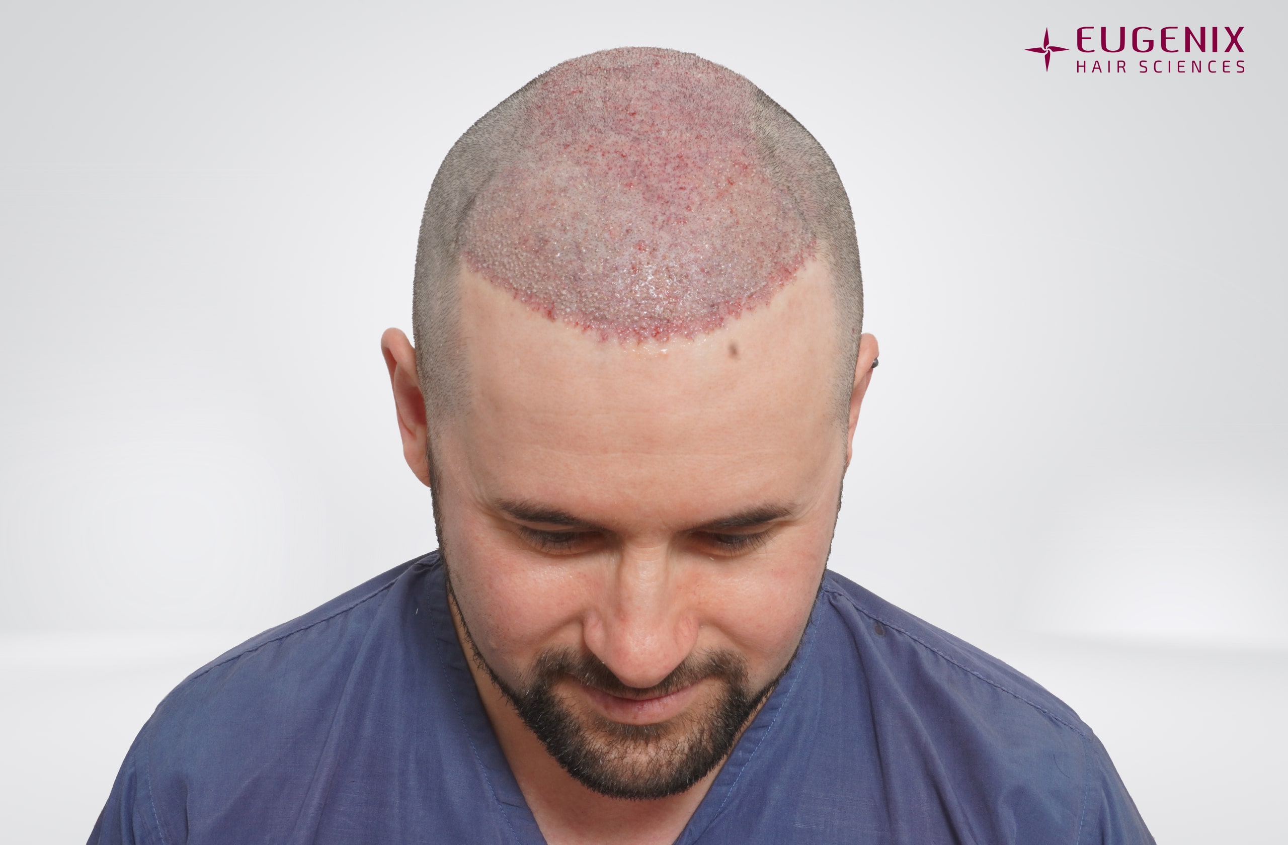 Thomas Wood Post-op Head Down copy