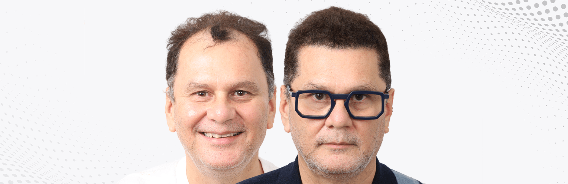 A Complete Guide to 3,500 Grafts Hair Transplant: Coverage, Donor Capacity & Results Expectations