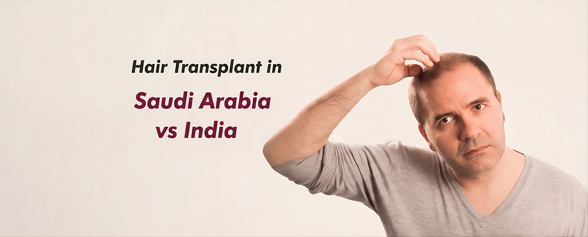 Hair Transplant in Saudi Arabia vs India: Cost, Quality and What Saudi Patients Need to Know