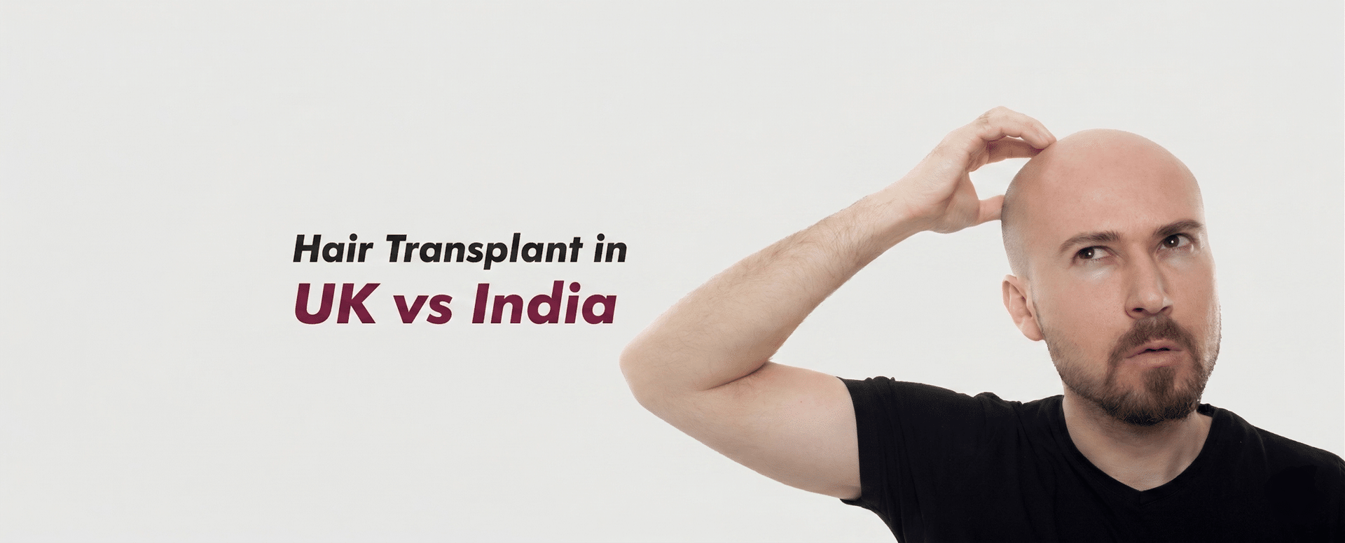 Hair Transplant in UK vs India: What UK Patients Need to Know Before Deciding