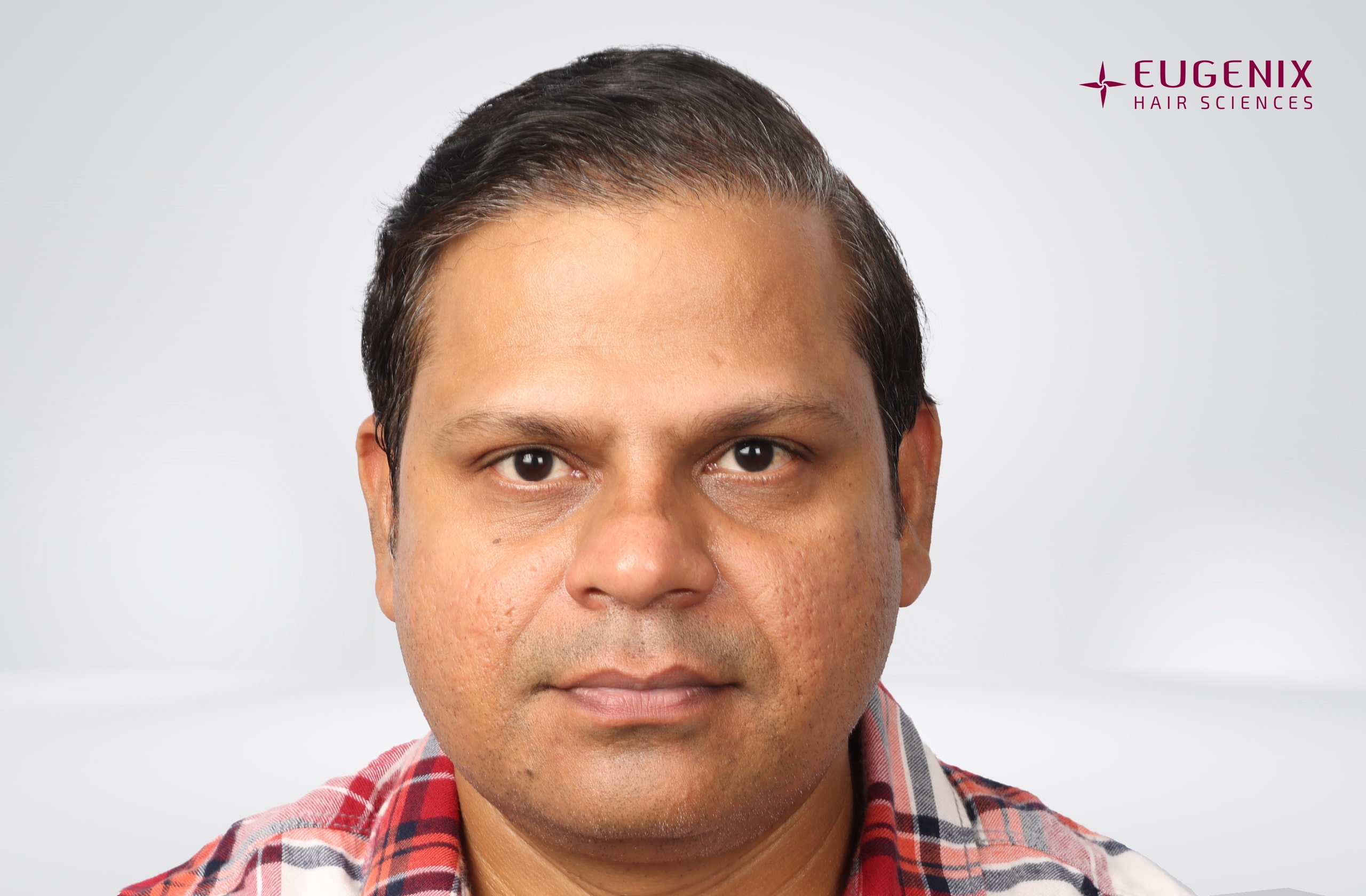 Rakesh Singh Rathore After Front copy
